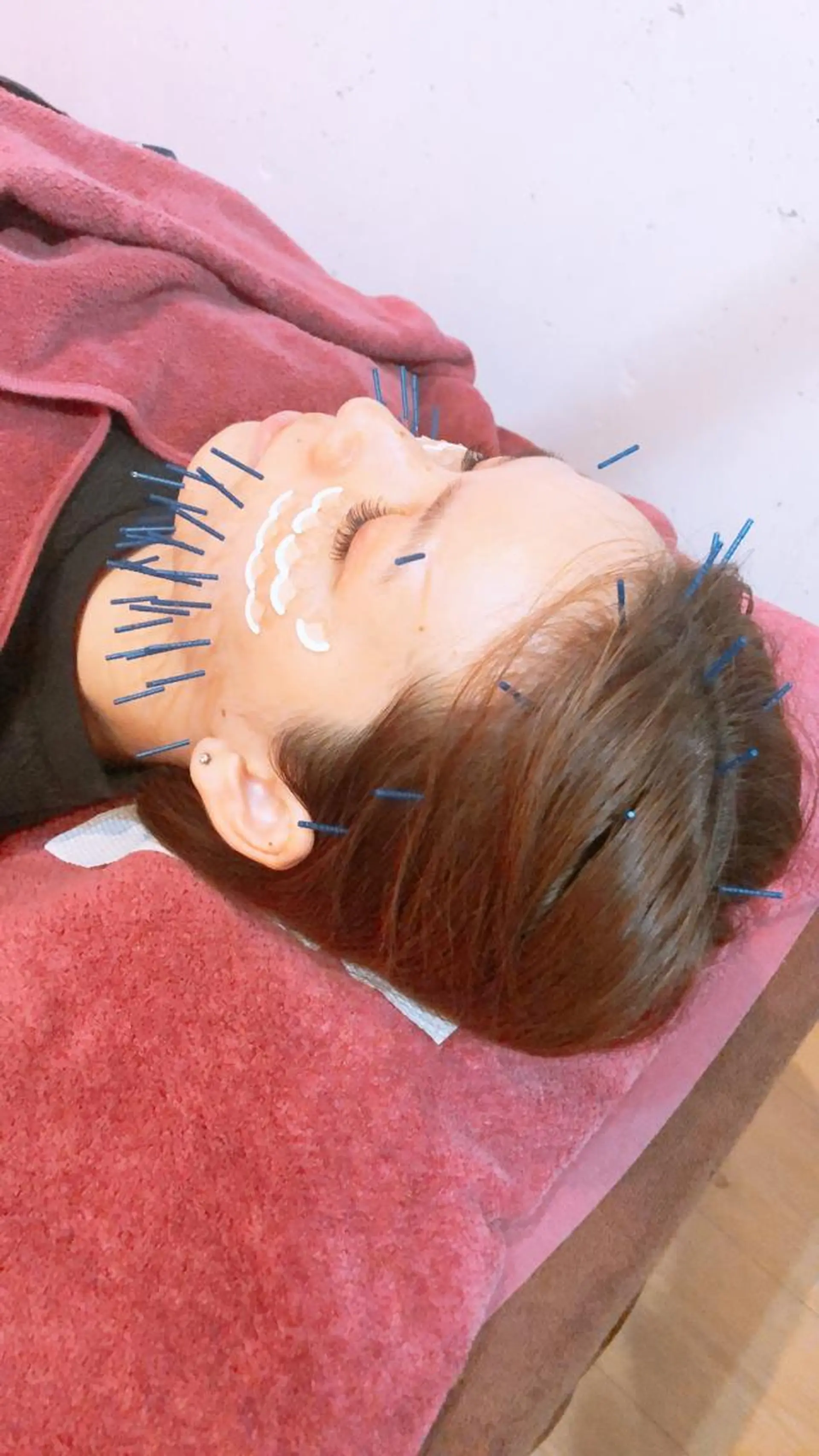 美容鍼灸女性専用 りんご鍼灸治療院のその他イメージ