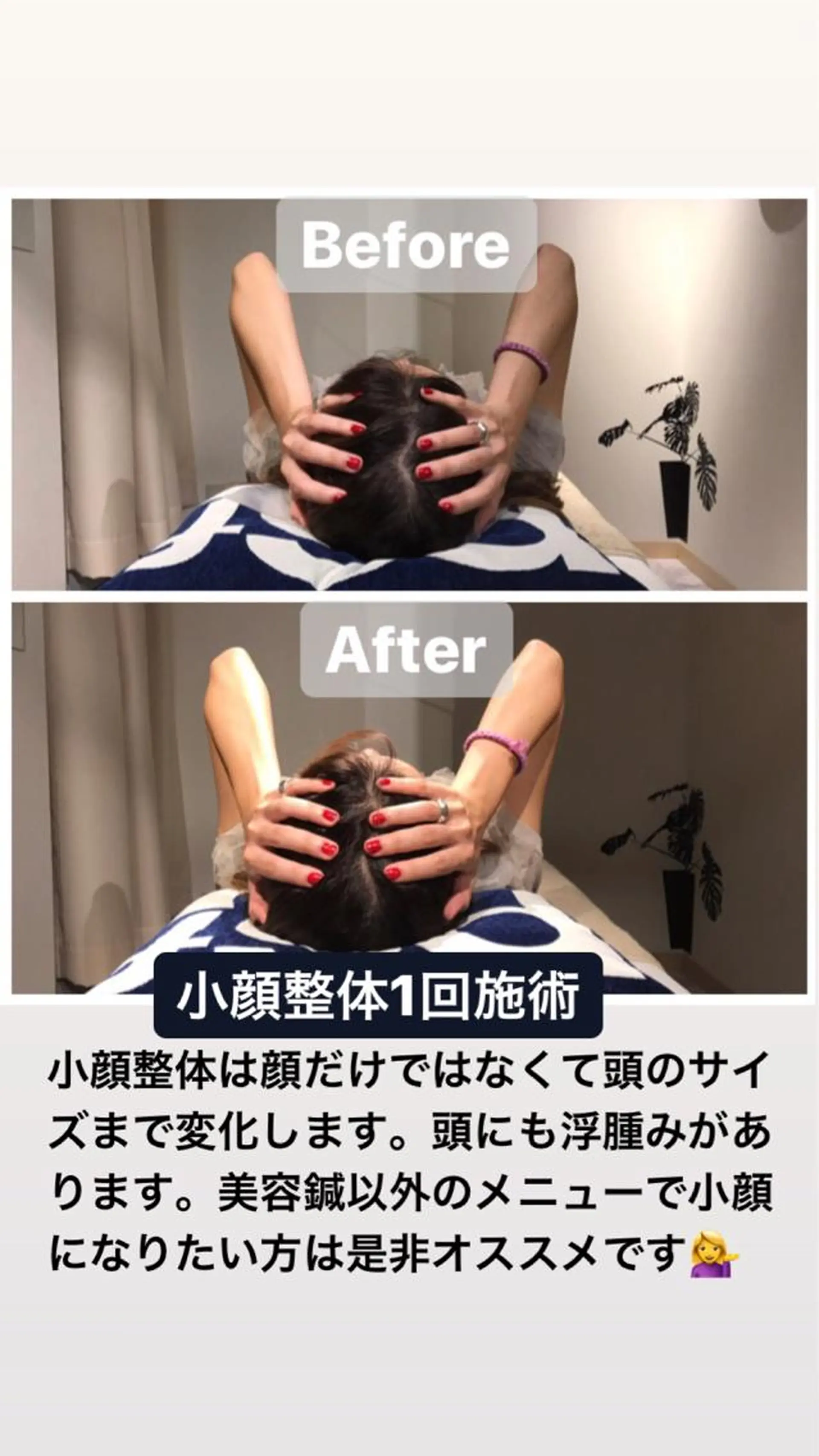 鍼灸整骨院Refine所属・鍼灸 Refineのその他イメージ