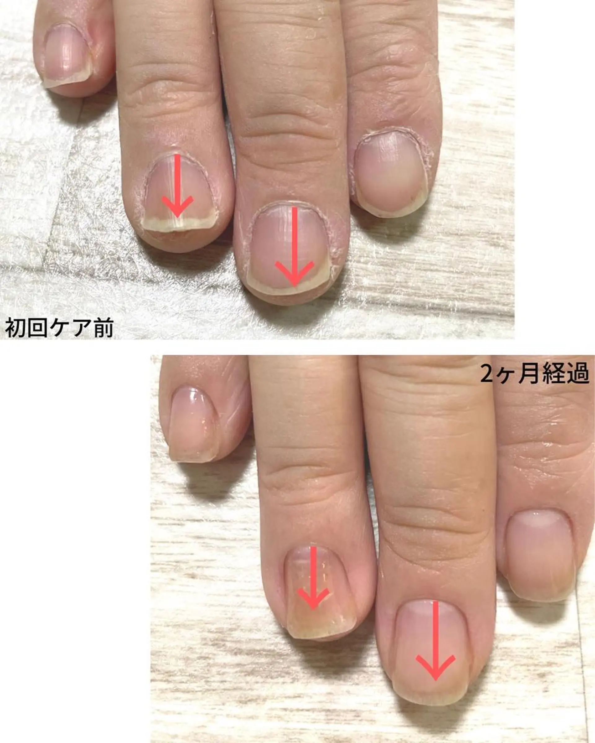 ネイル Ka pilina所属・自爪育成専門店 Kapilinaのネイルデザイン
