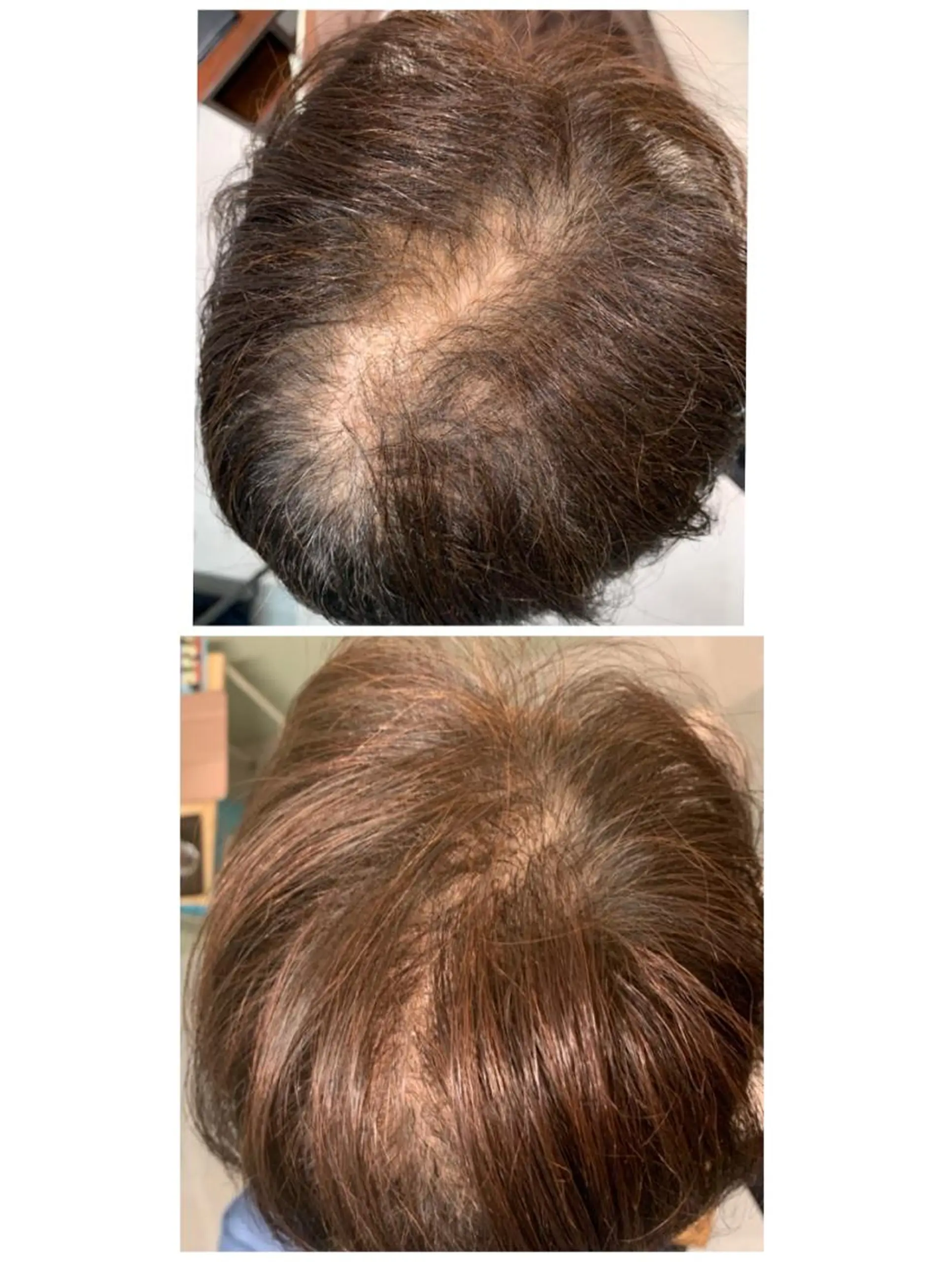 ショート ヘアアレンジ Kanal Kanaのエステ・リラクイメージ