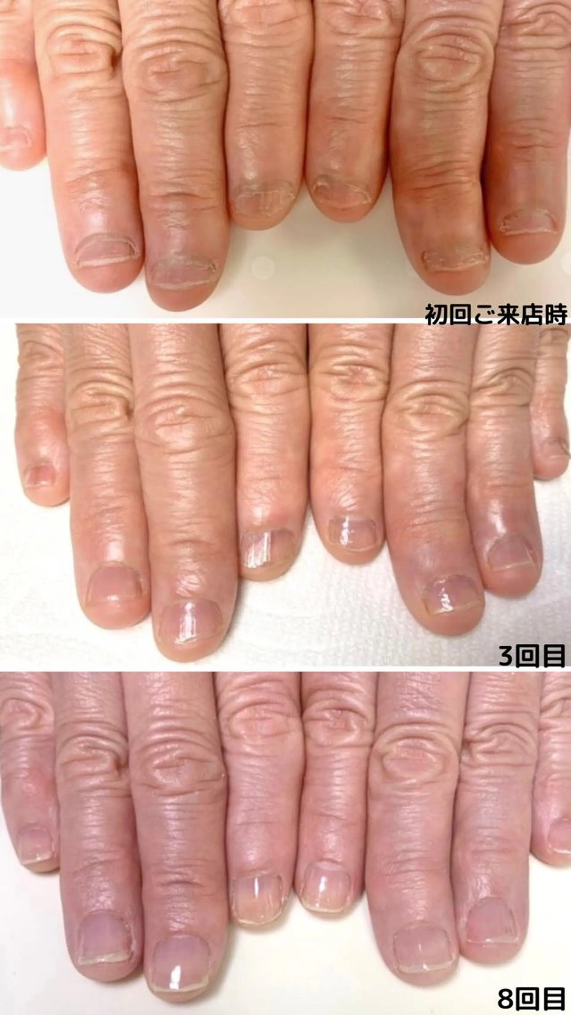 ネイル ハンドネイル ハンドケア Ka pilina所属・自爪育成専門店 Kapilinaのネイルデザイン