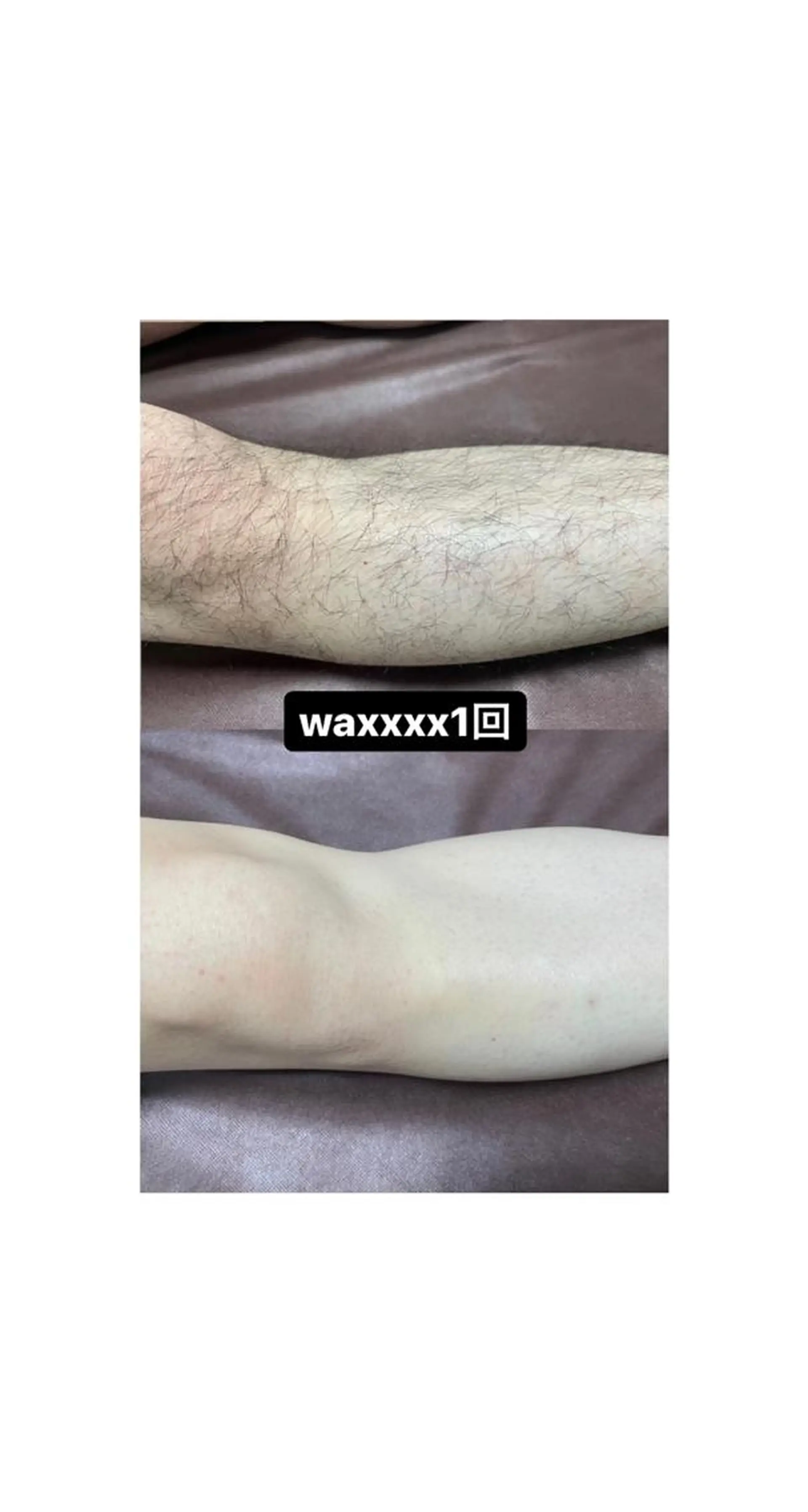 脱毛 Epina 千葉店 【エピナ】のエステ・リラクイメージ