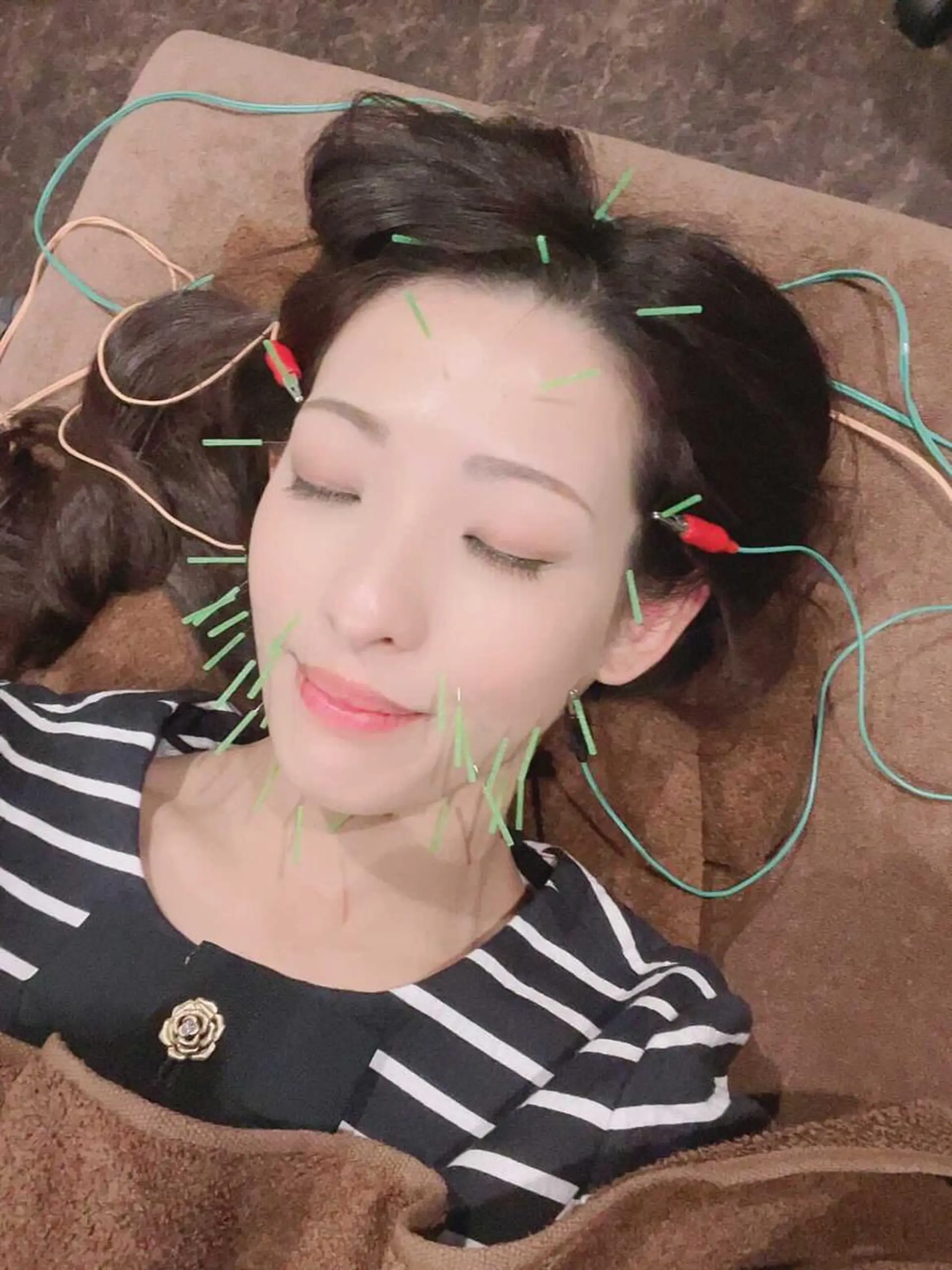 メンズ エステ リラク 美容鍼灸サロン LOMIHARIのエステ・リラクイメージ