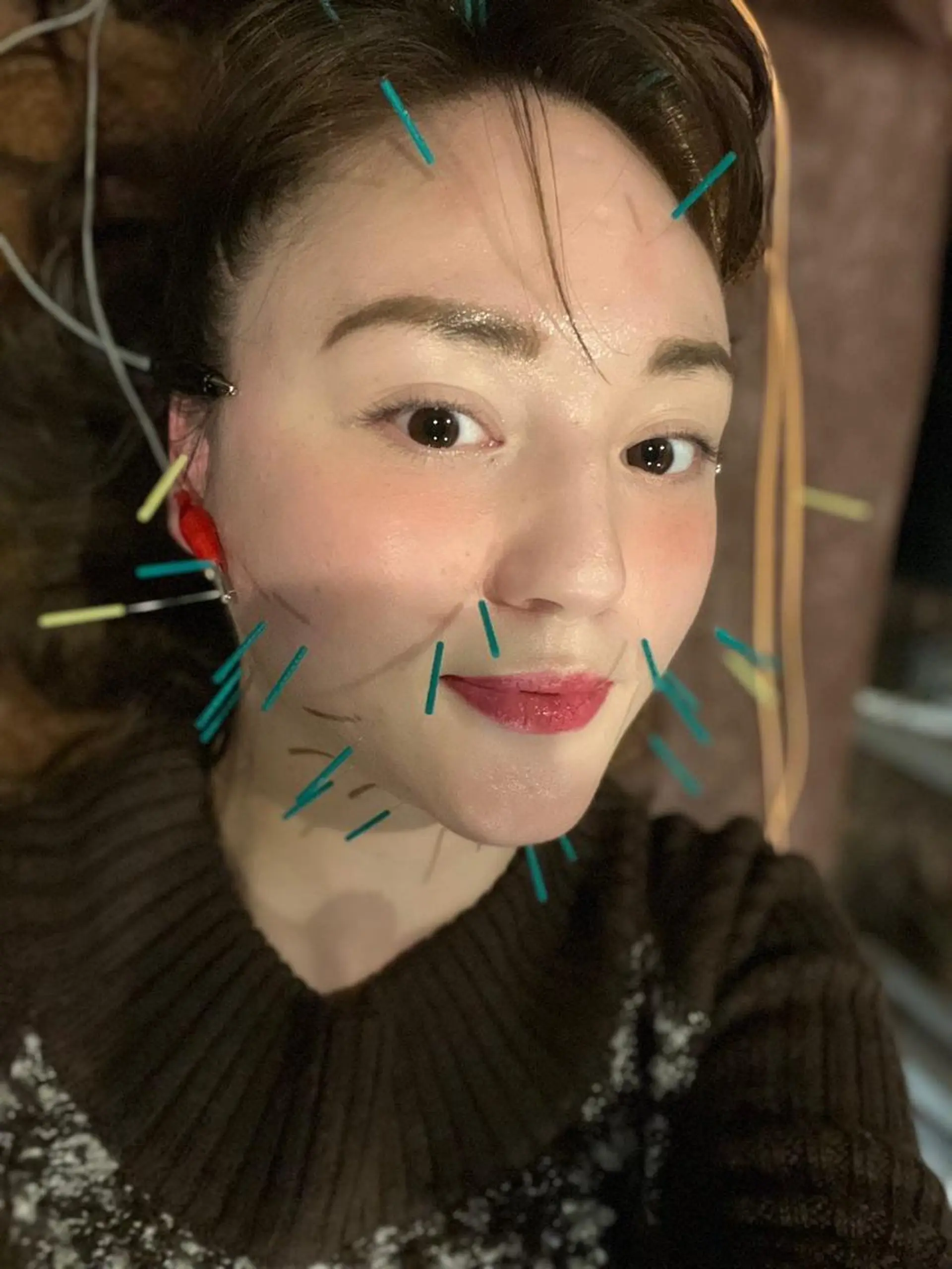 メンズ エステ リラク 美容鍼灸サロン LOMIHARIのエステ・リラクイメージ