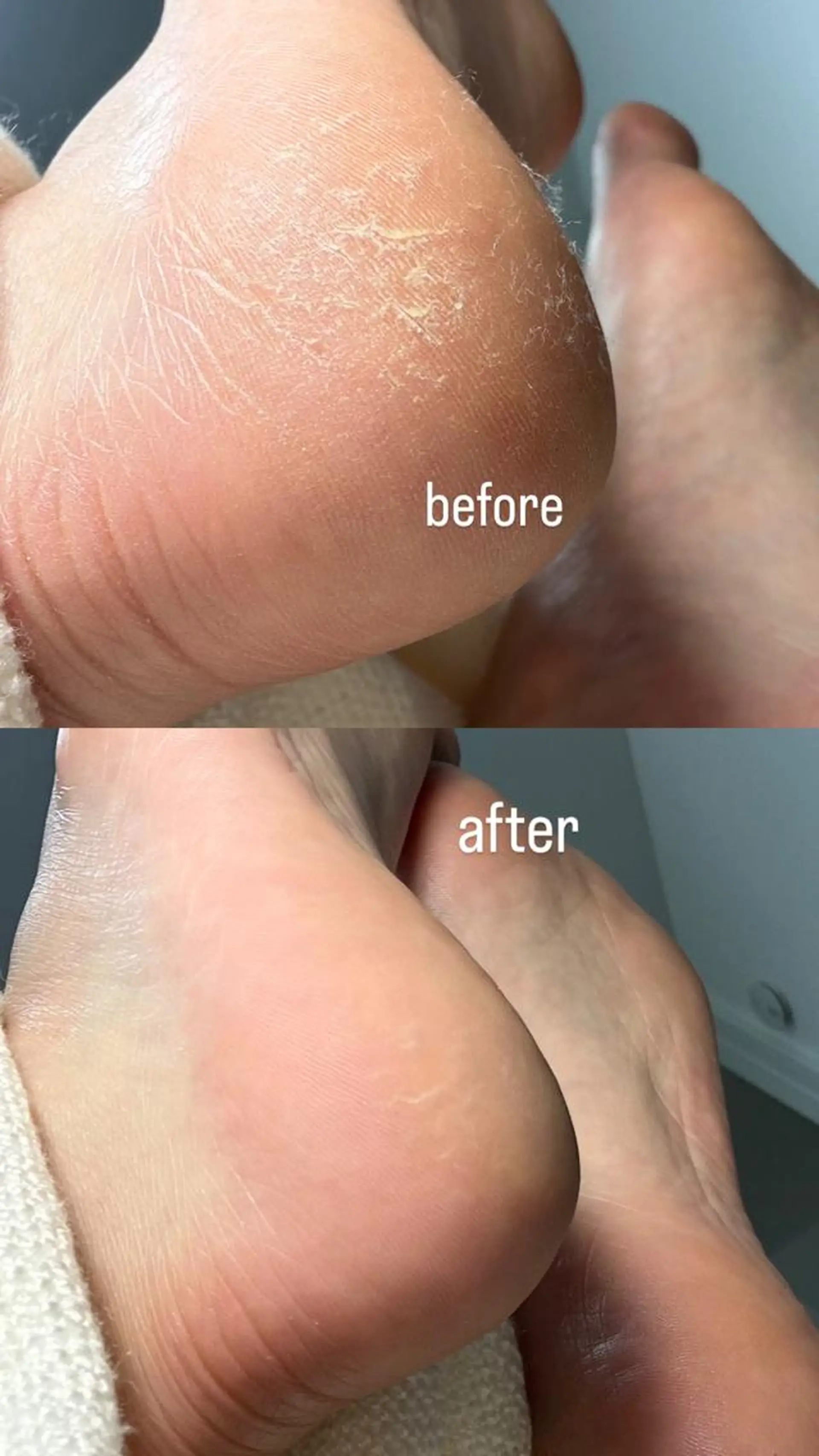 ネイル 12 designのネイルデザイン