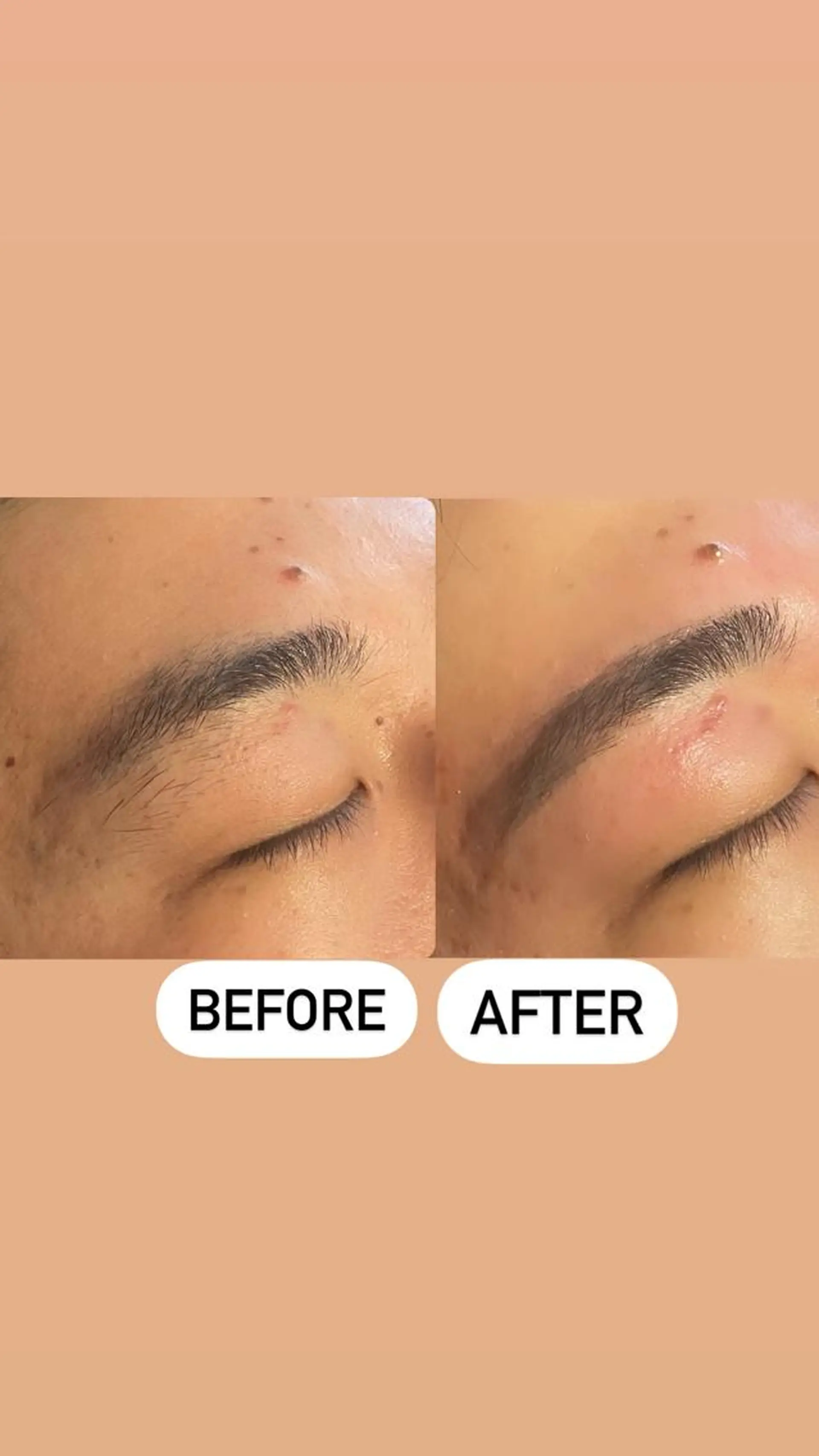 メンズ アイブロウ ワックス脱毛 眉カット その他(アイブロウ) メンズ眉毛ITSUK Iメンズ専門　新宿の眉毛・アイブロウイメージ