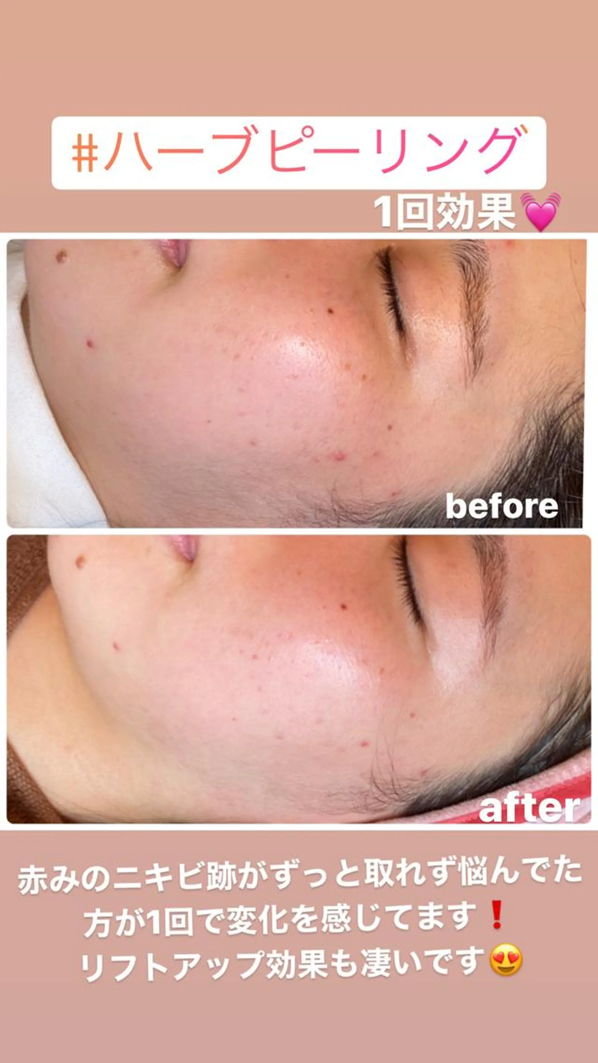 FLEUR大阪・整体 ・ハイフ・痩身・小顔のエステ・リラクイメージ