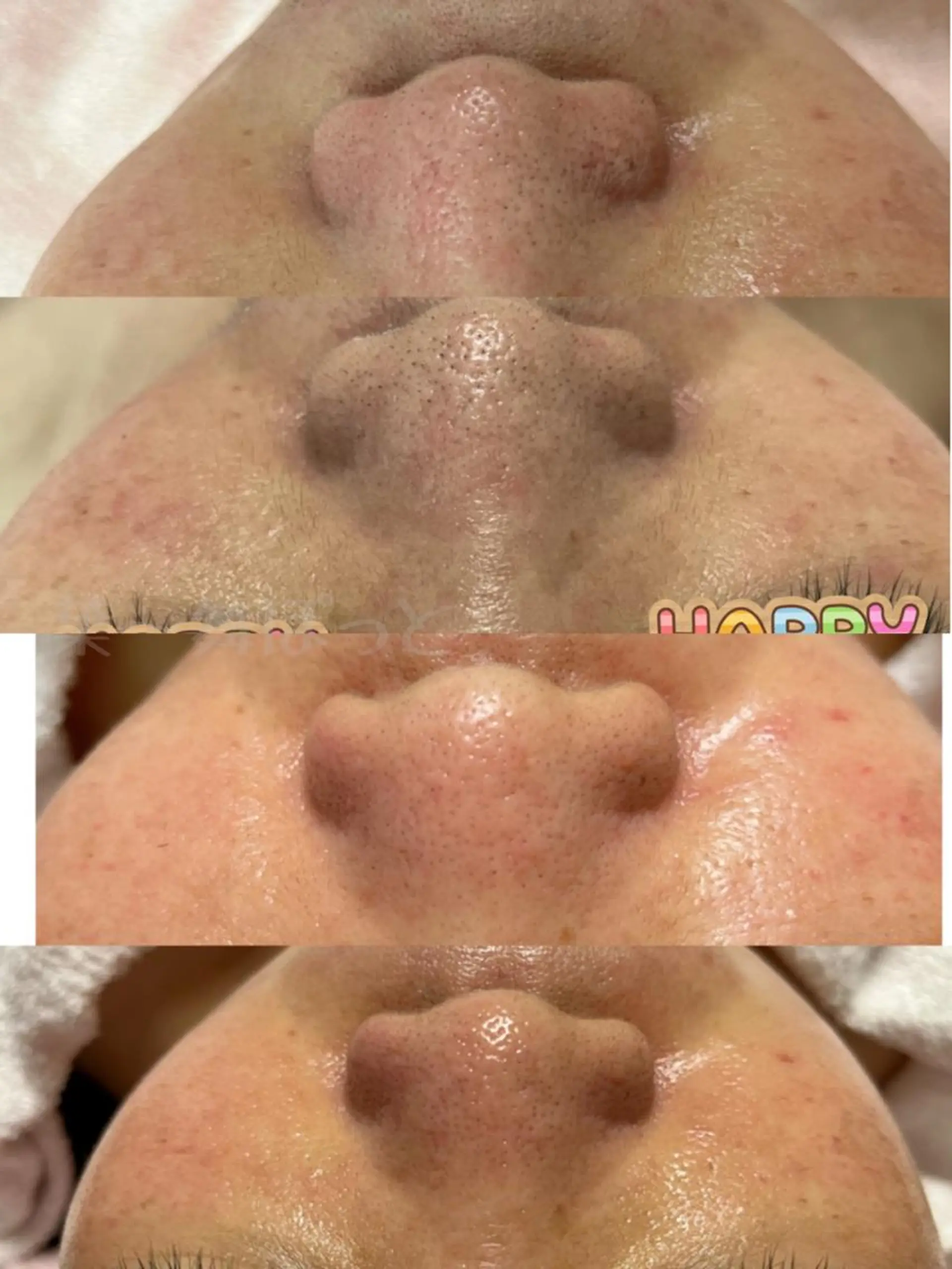 うえつま ふみえのエステ・リラクイメージ