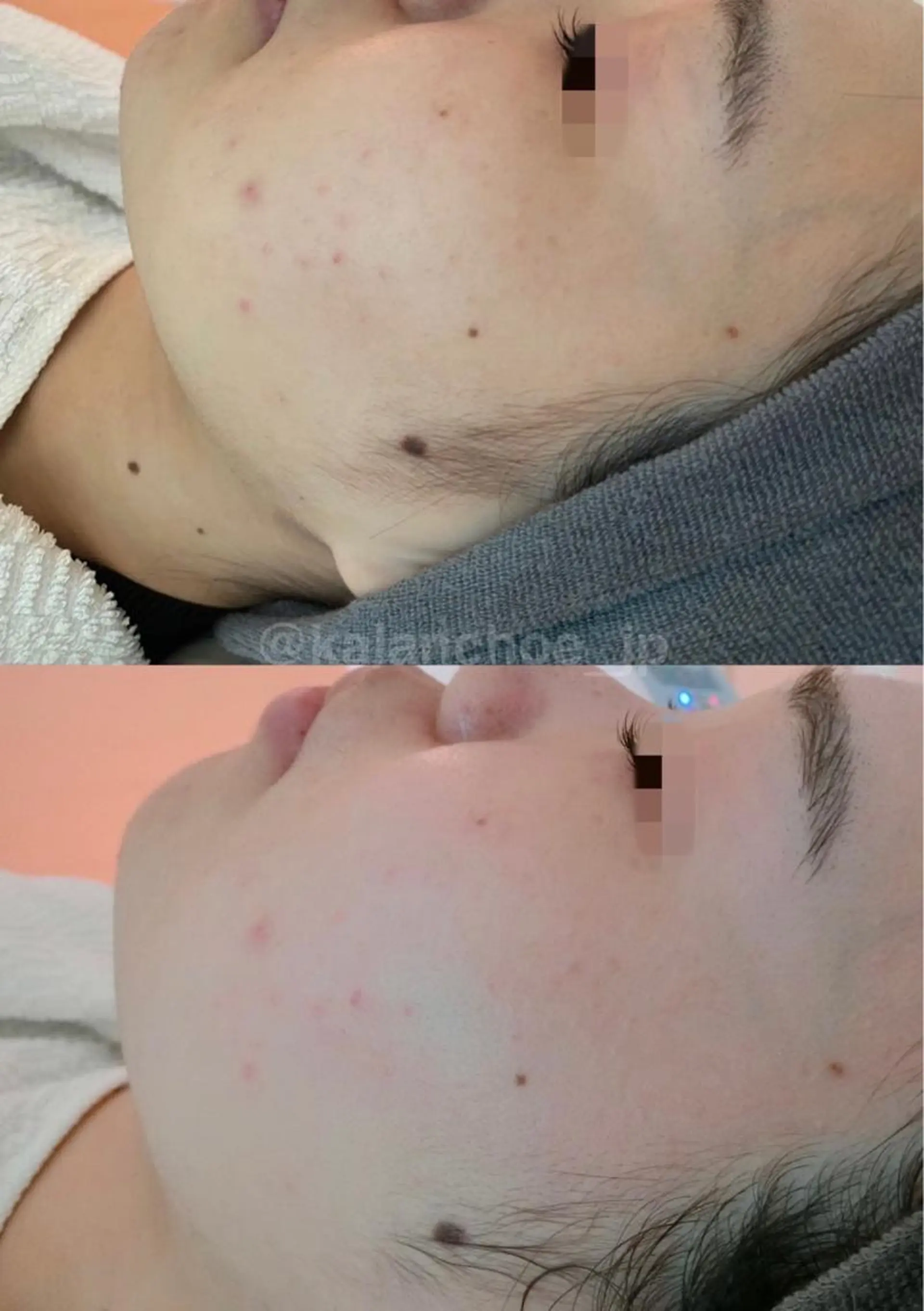 エステ 肌質改善 KALANCHOEのエステ・リラクイメージ