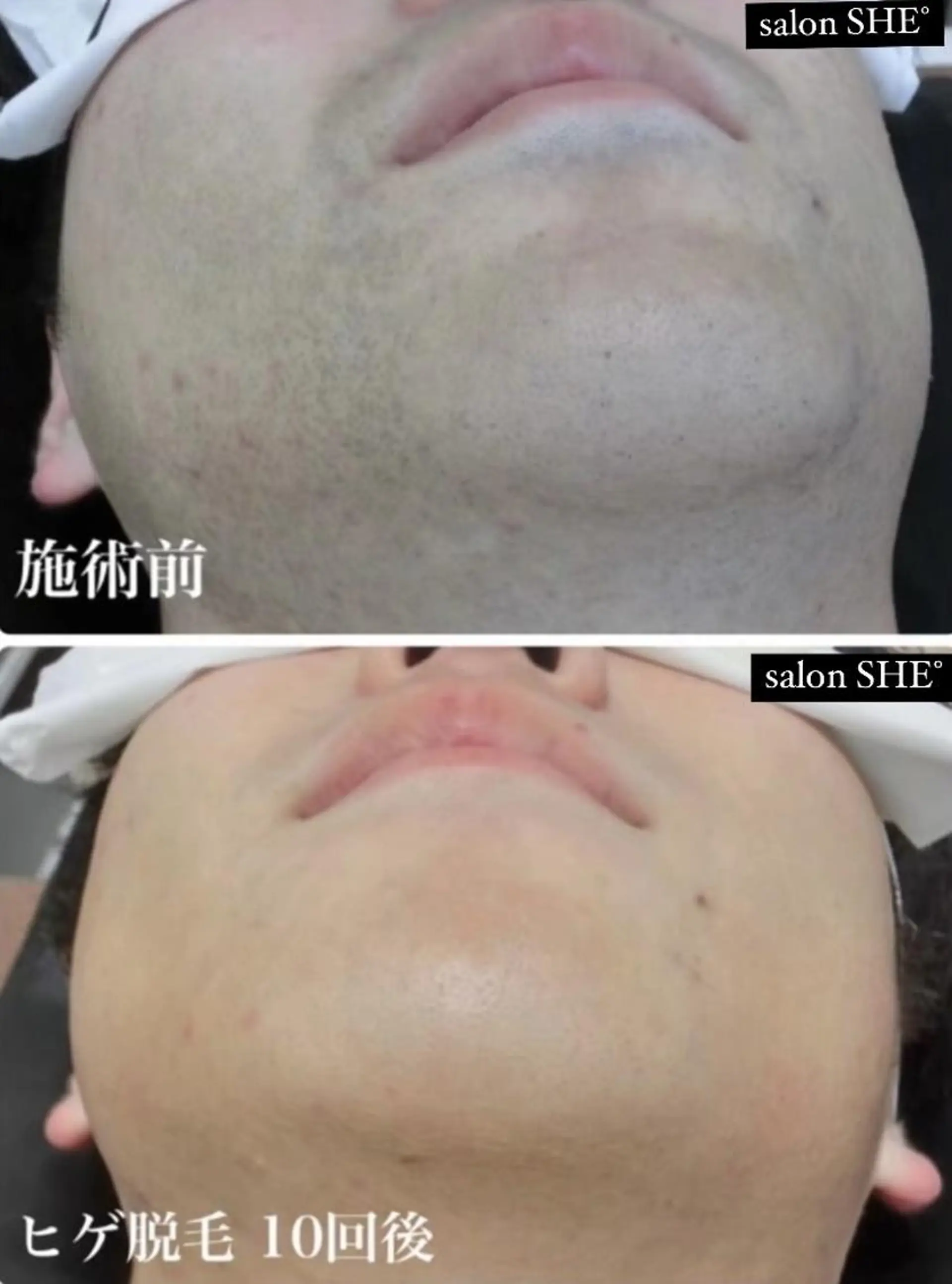 脱毛 salon SHE° 新宿店🩵のその他イメージ