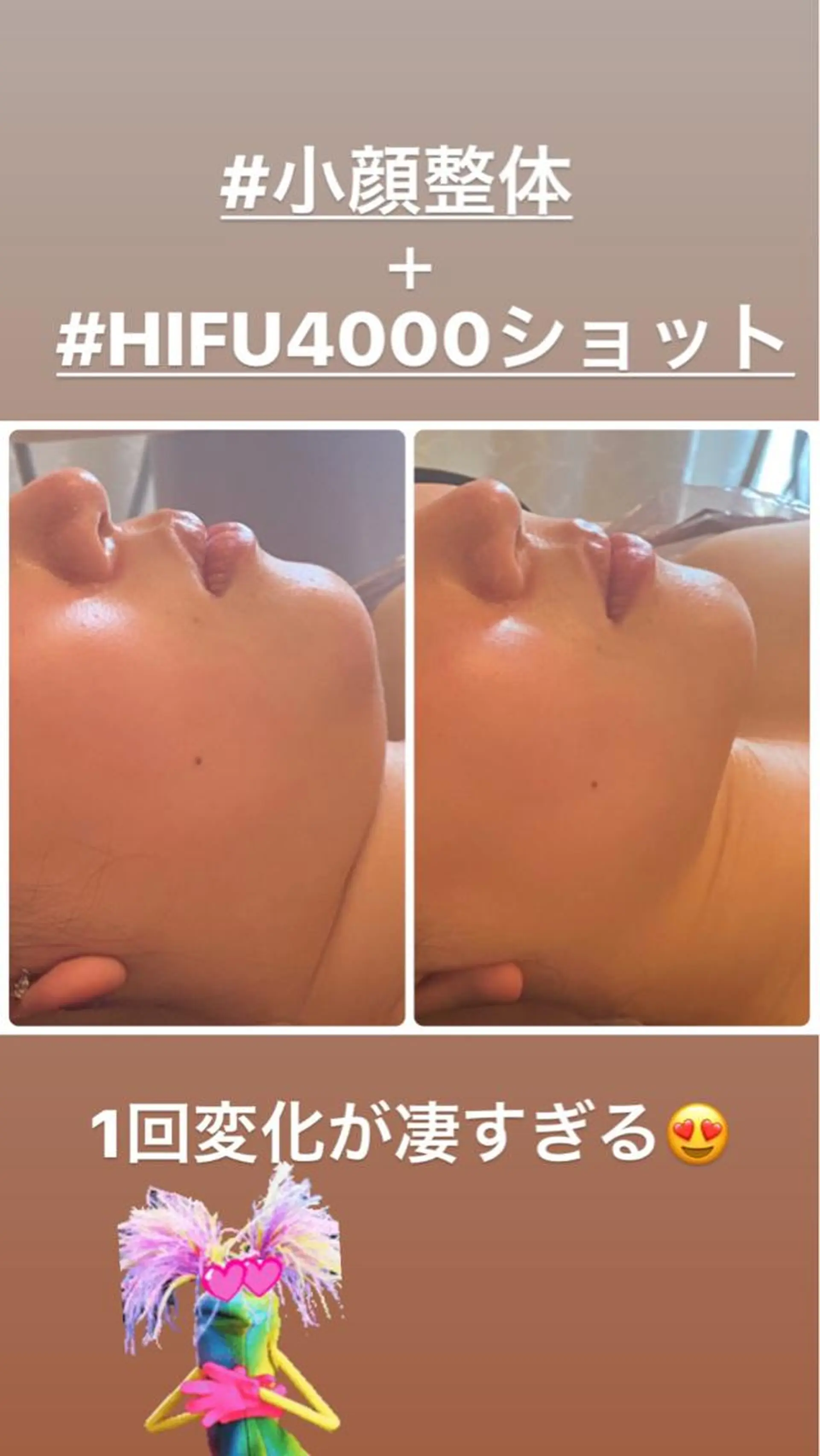 FLEUR大阪・整体 ・ハイフ・痩身・小顔のエステ・リラクイメージ