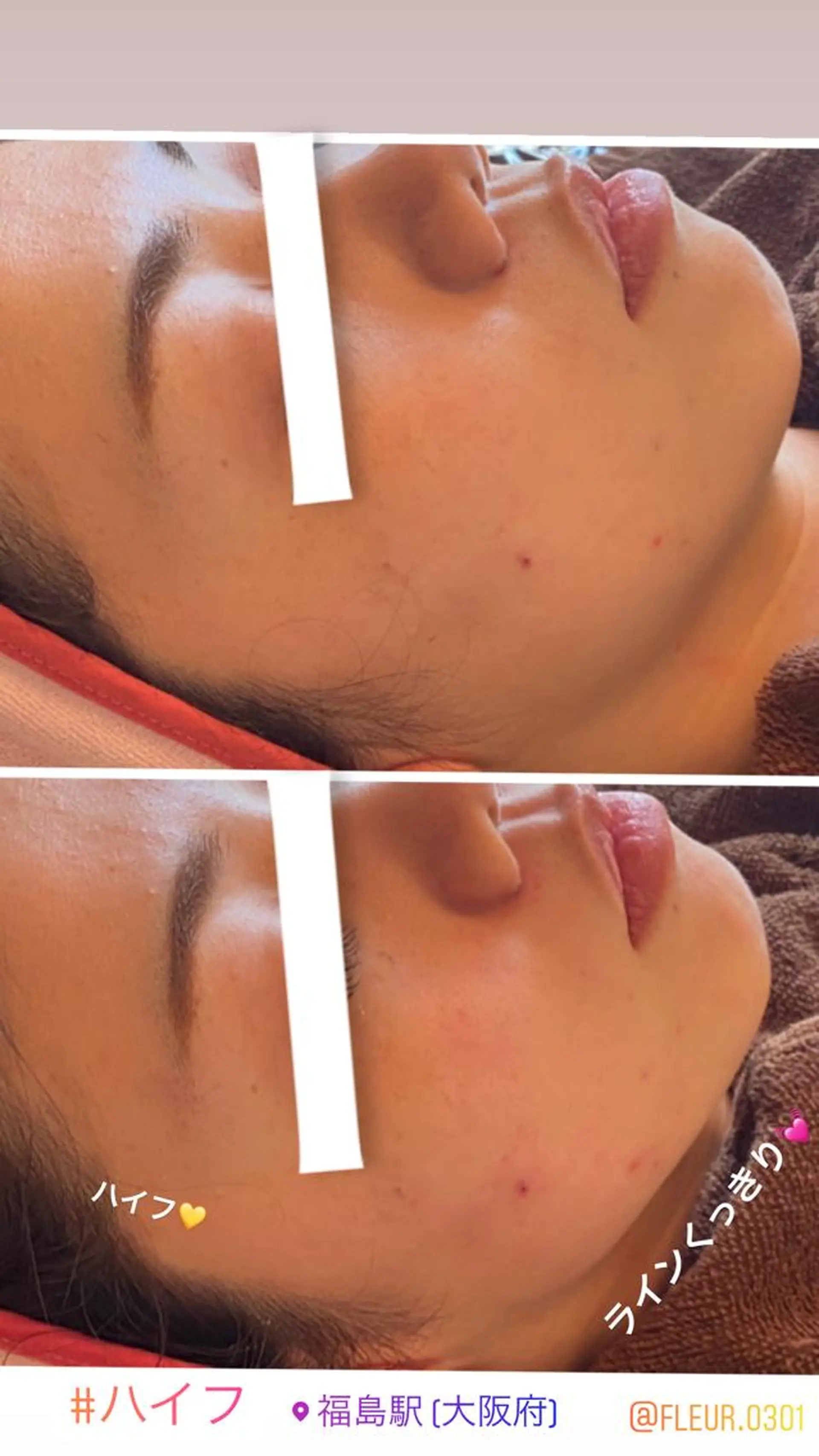 FLEUR大阪・整体 ・ハイフ・痩身・小顔のエステ・リラクイメージ