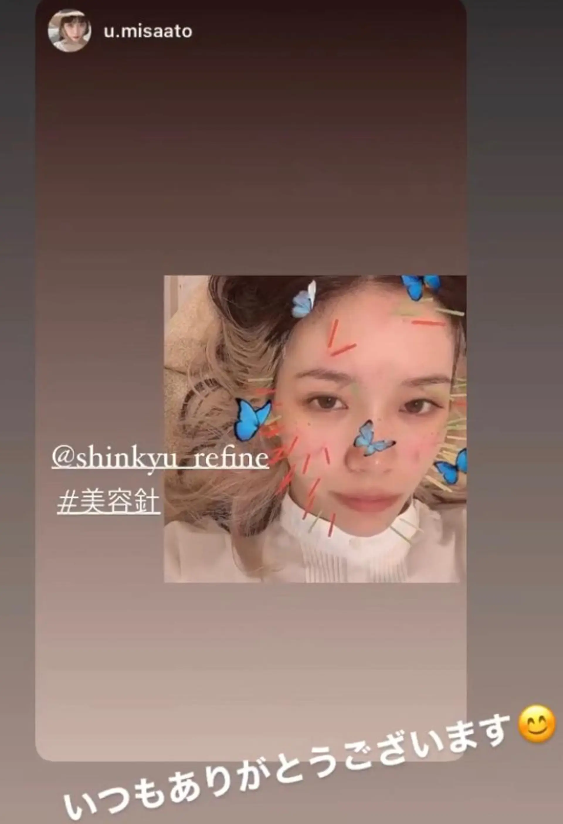 鍼灸整骨院Refine所属・鍼灸 Refineのその他イメージ