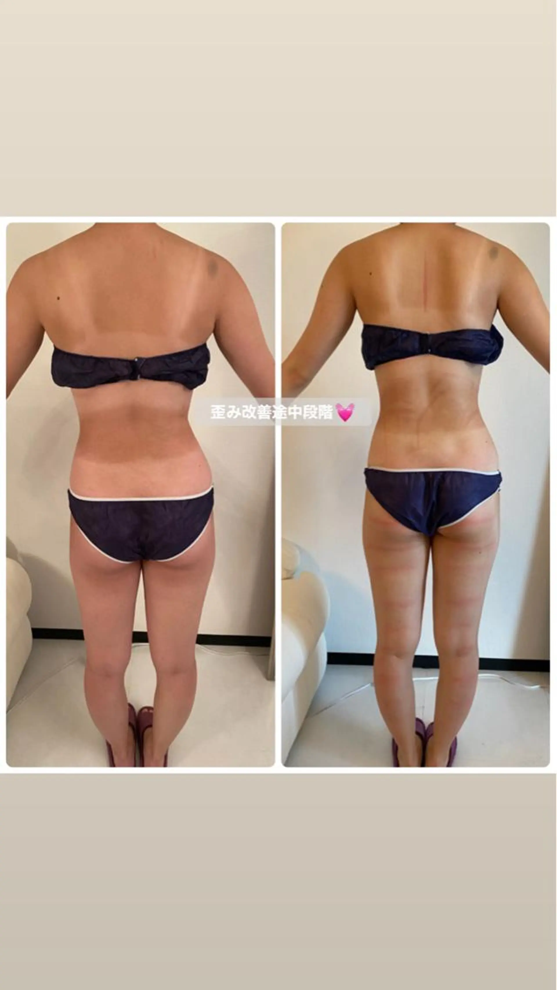 FLEUR大阪・整体 ・ハイフ・痩身・小顔のエステ・リラクイメージ