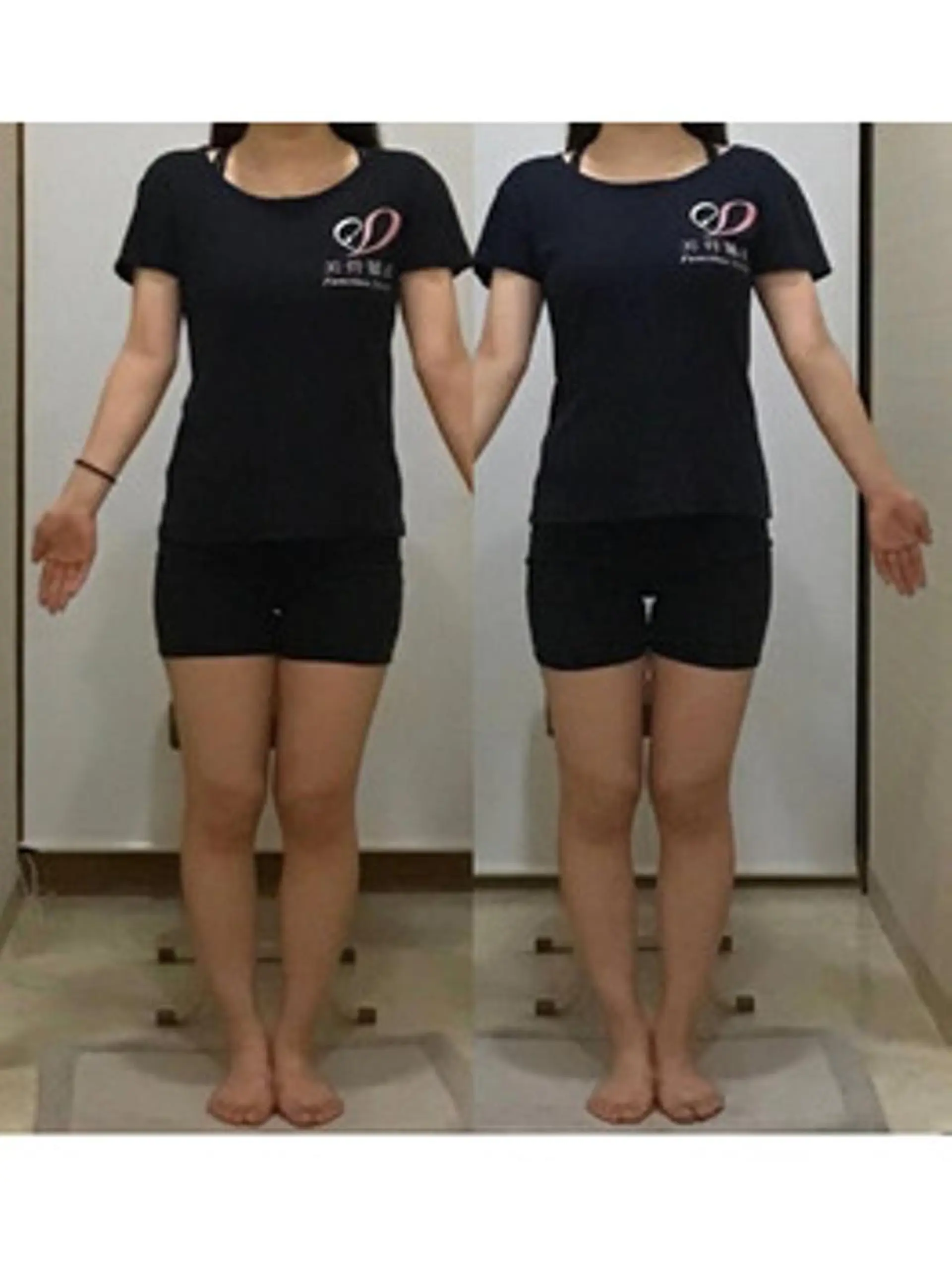 姿勢・骨盤/小顔矯正 痩身ダイエット 横田のエステ・リラクイメージ