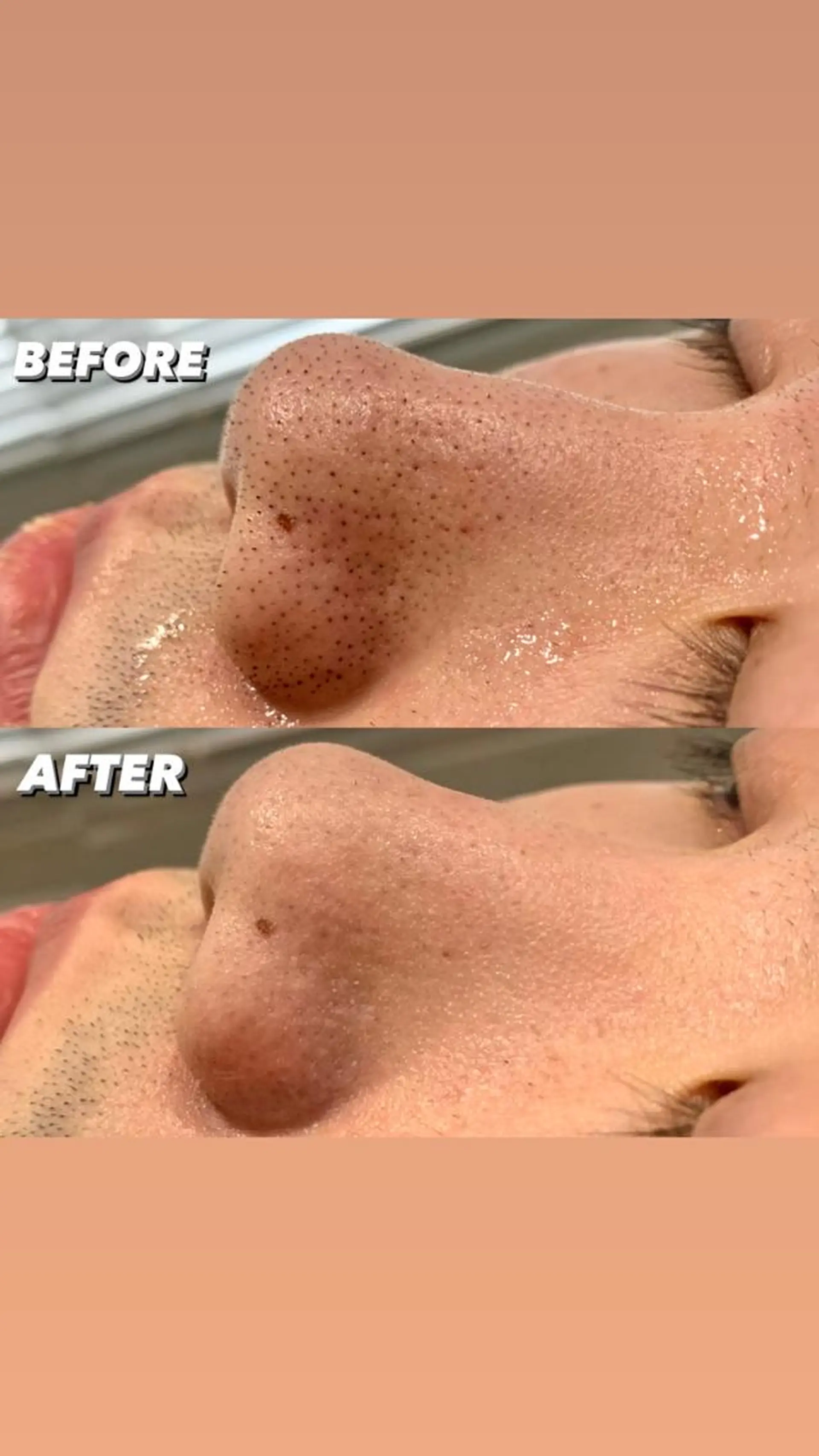 ミディアム カラー パーマ ヘアアレンジ メンズ キッズ ネイル マツエク・マツパ エステ リラク NANI OAFU所属・NANIOAFU [なんば店］のその他イメージ