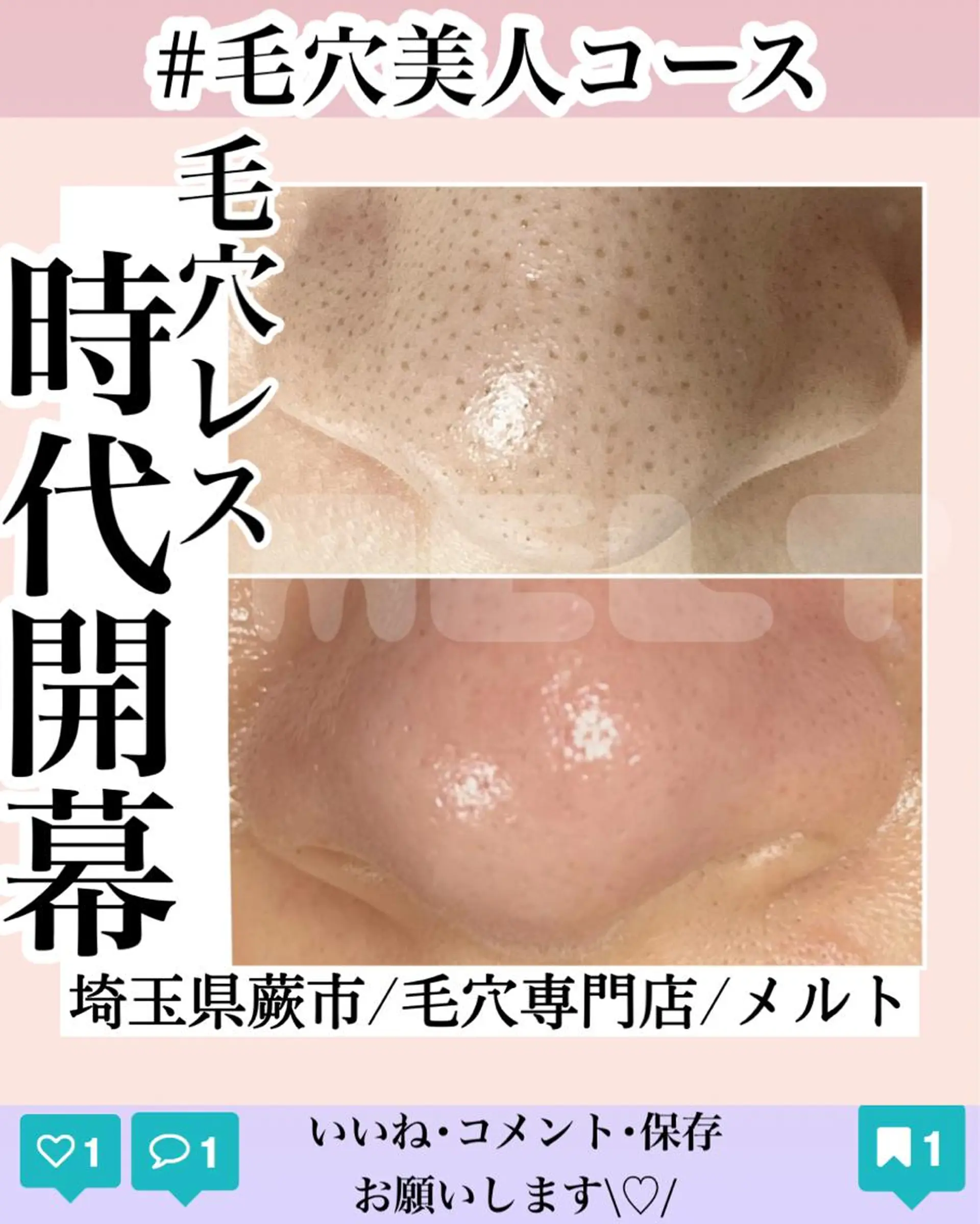 melt まみのマツエク・マツパデザイン