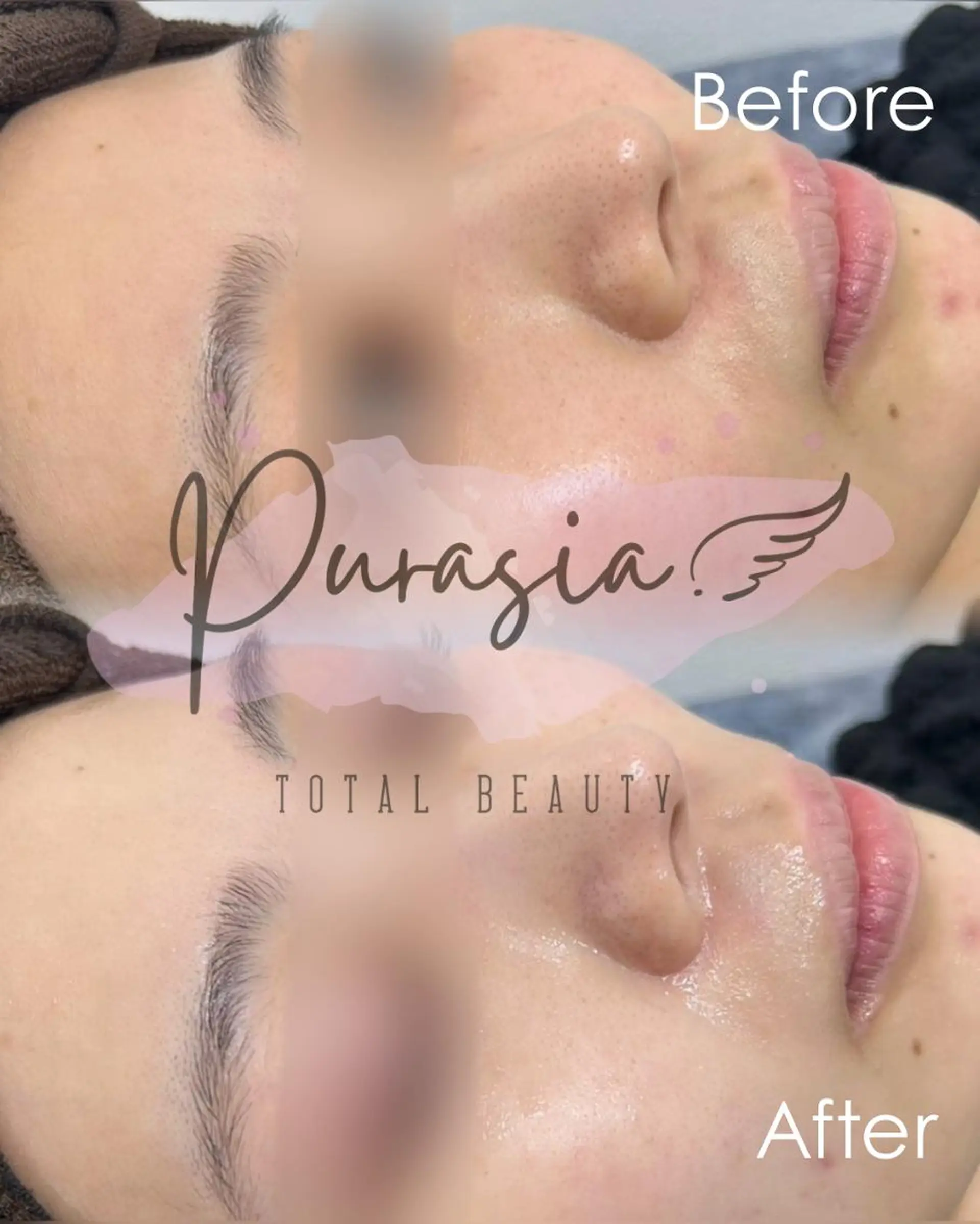 エステ 🪞Purasia. 🫧韓国肌管理💎のエステ・リラクイメージ