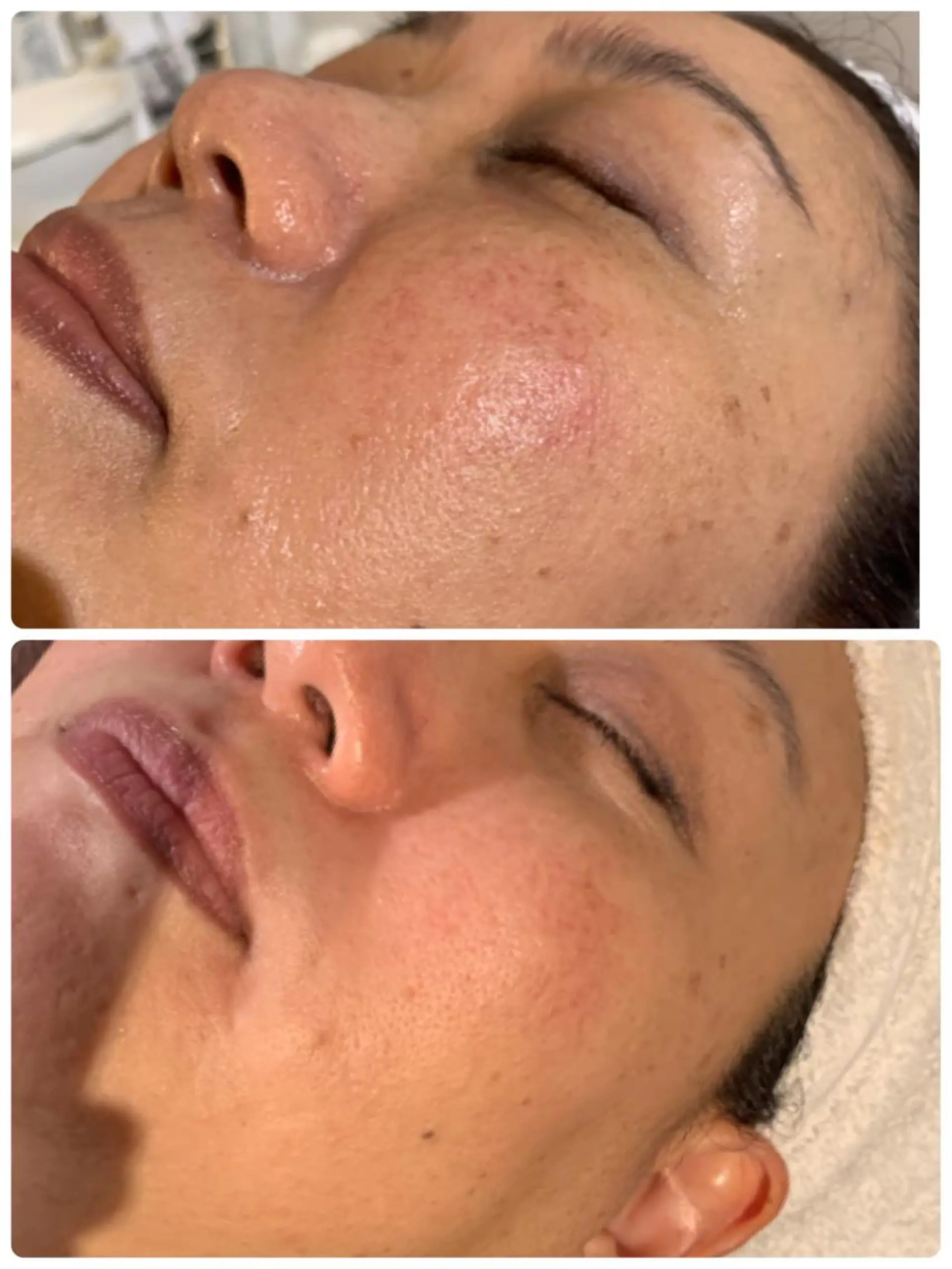 esty hitomiのエステ・リラクイメージ