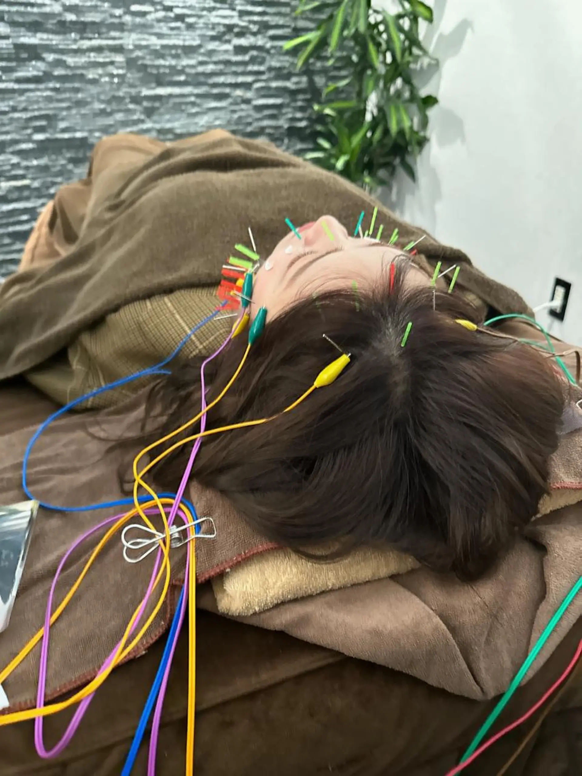 その他 美容鍼灸整体サロンBeauJu所属・小顔矯/美容鍼/鍼灸 BeauJuのその他イメージ