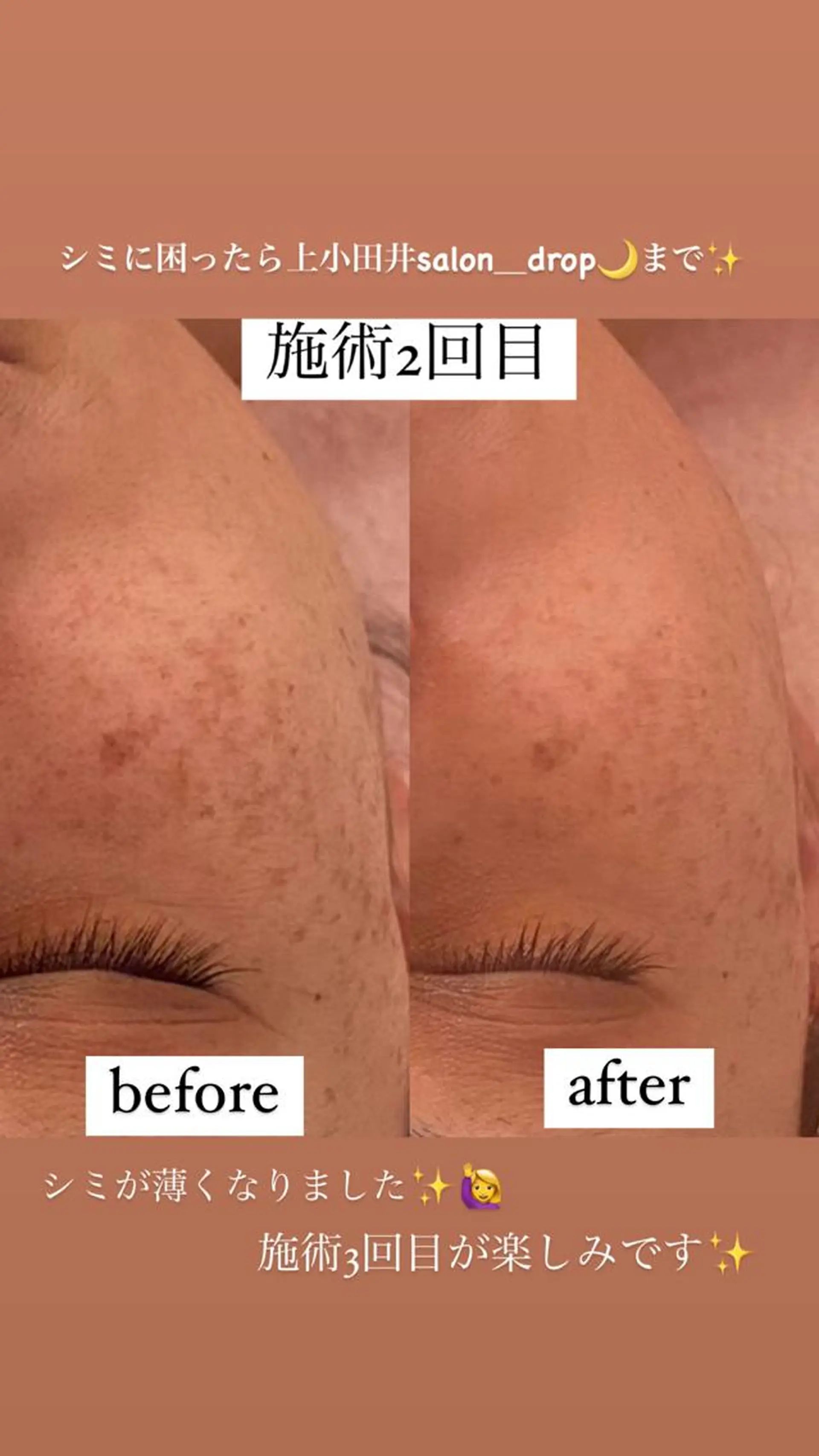 salon＿drop所属・salon dropのエステ・リラクイメージ