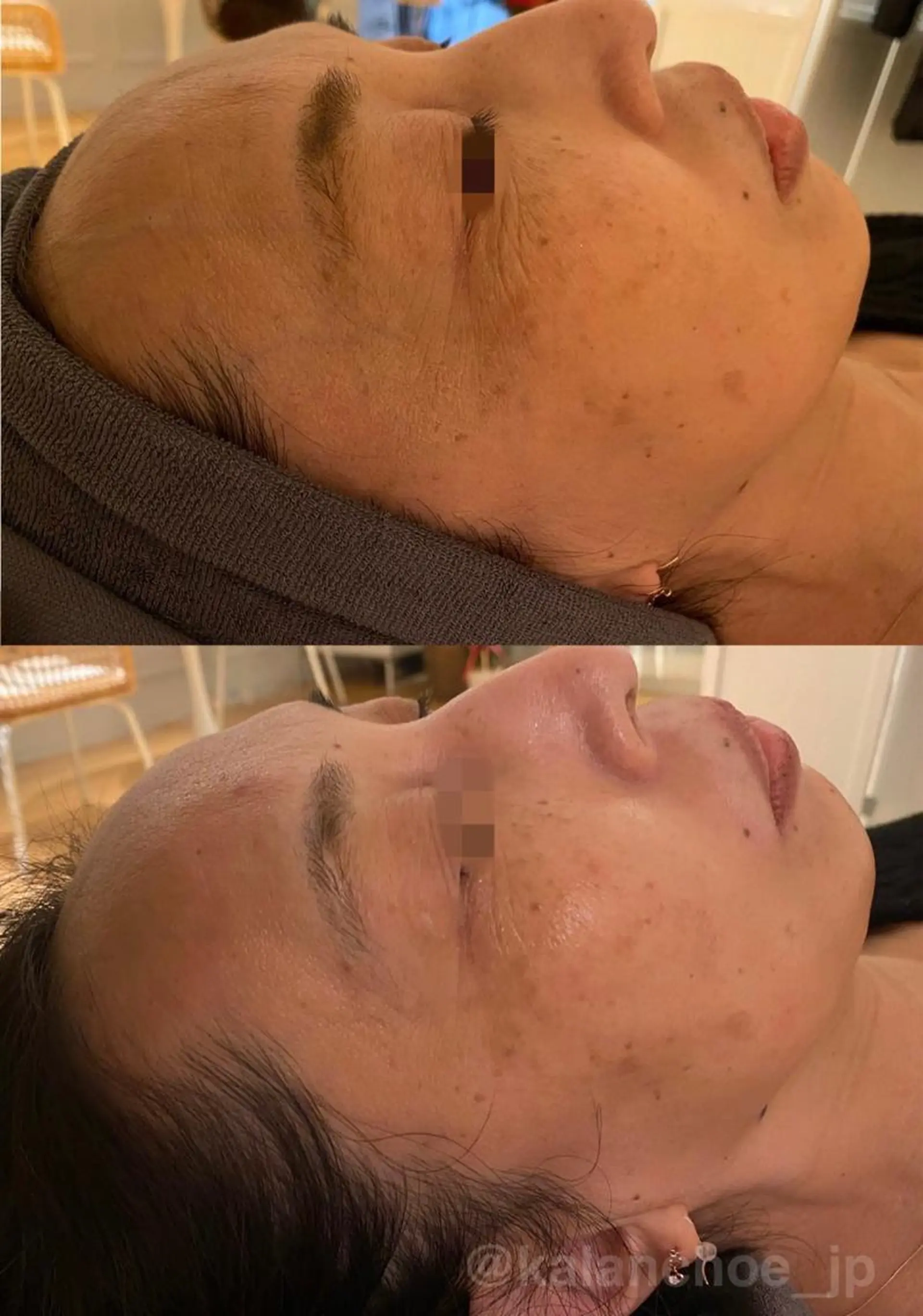 エステ 肌質改善 KALANCHOEのエステ・リラクイメージ