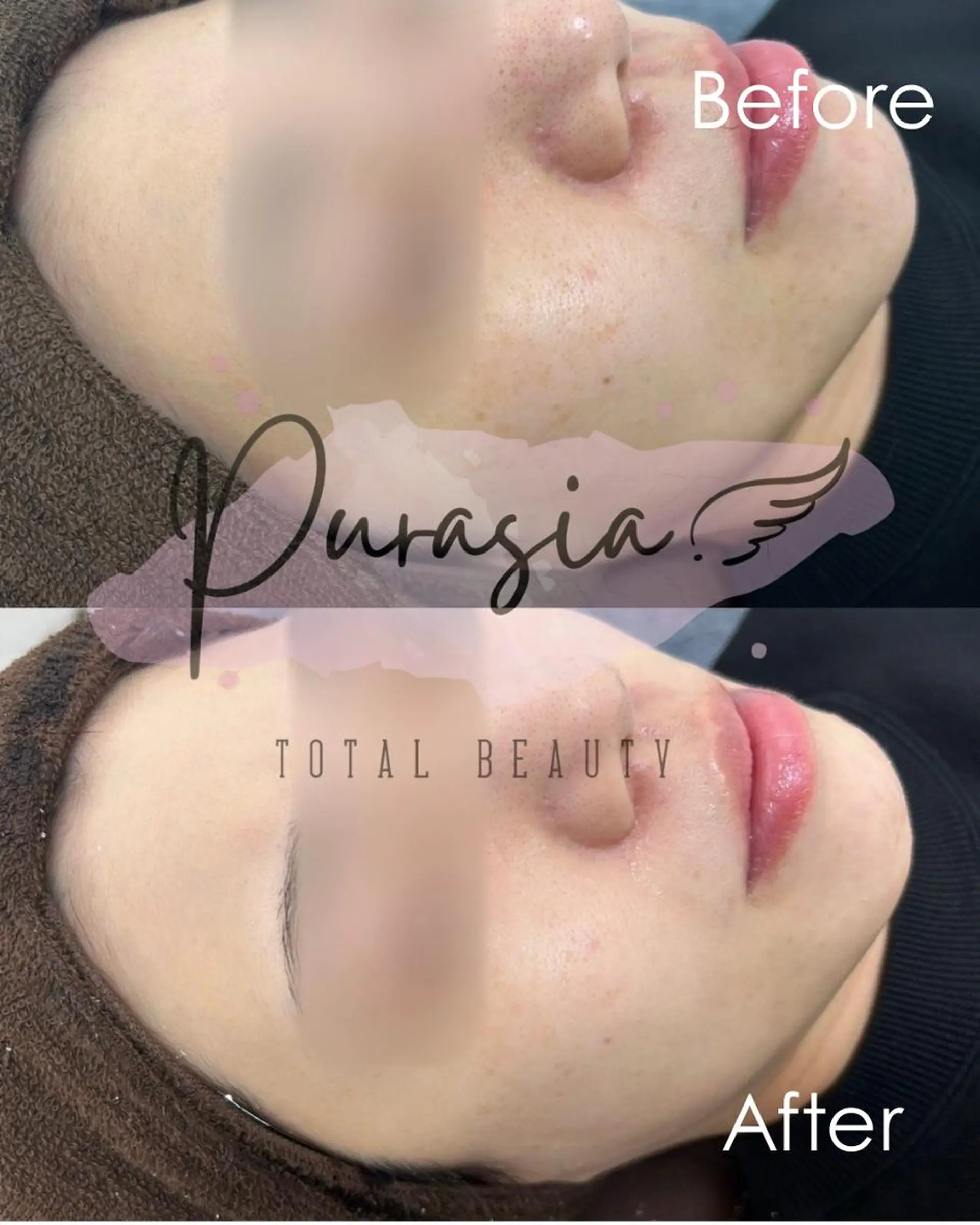 エステ 🪞Purasia. 🫧韓国肌管理💎のエステ・リラクイメージ