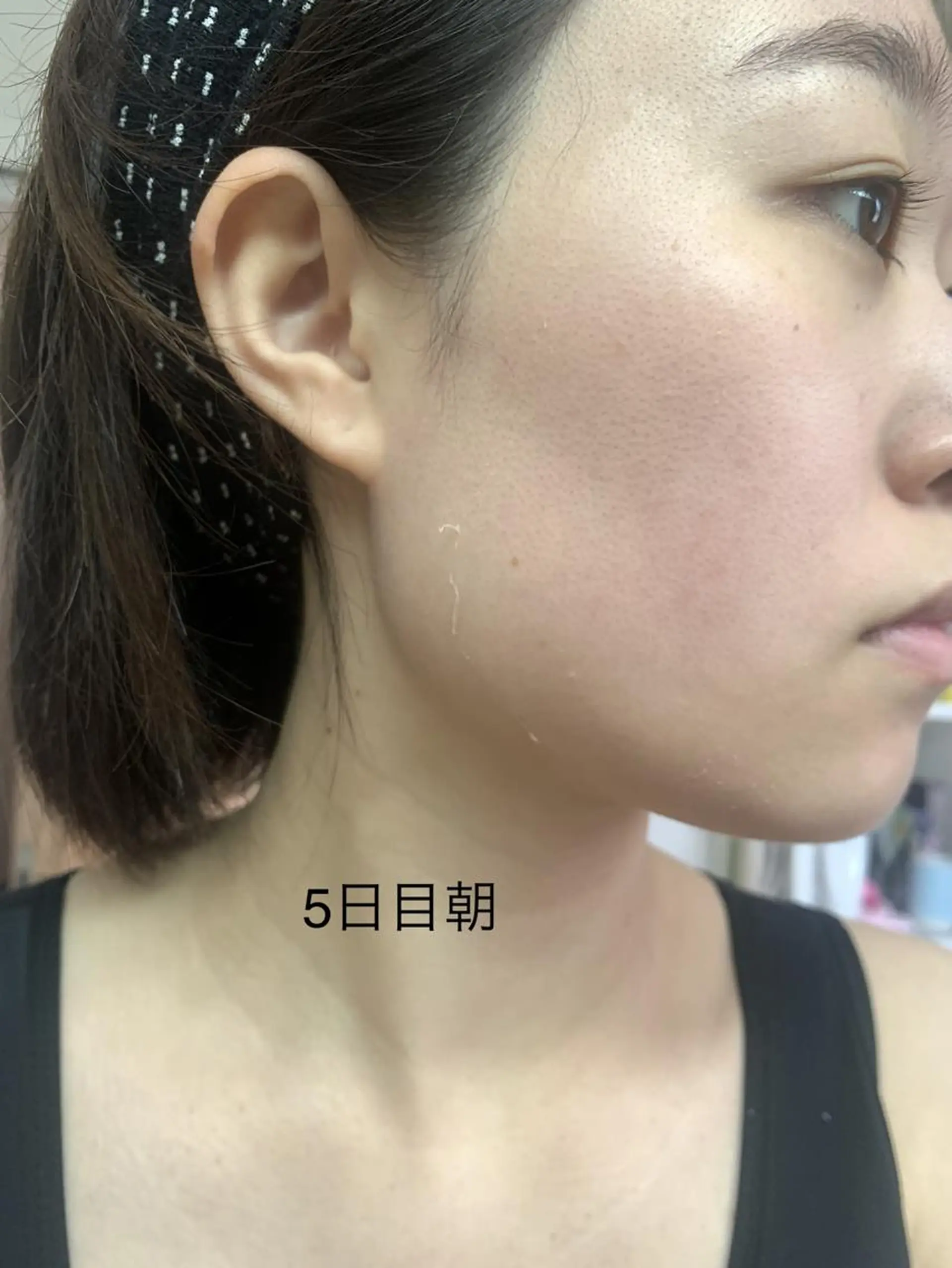 U24💗学割エステ 💗RAYVIS池袋のエステ・リラクイメージ