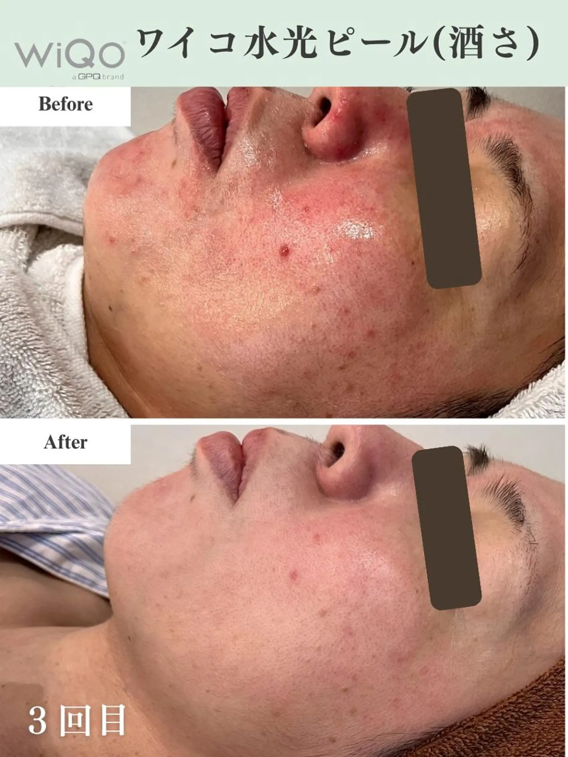 脱毛・眉毛・フェイス サロンN久留米店のその他イメージ