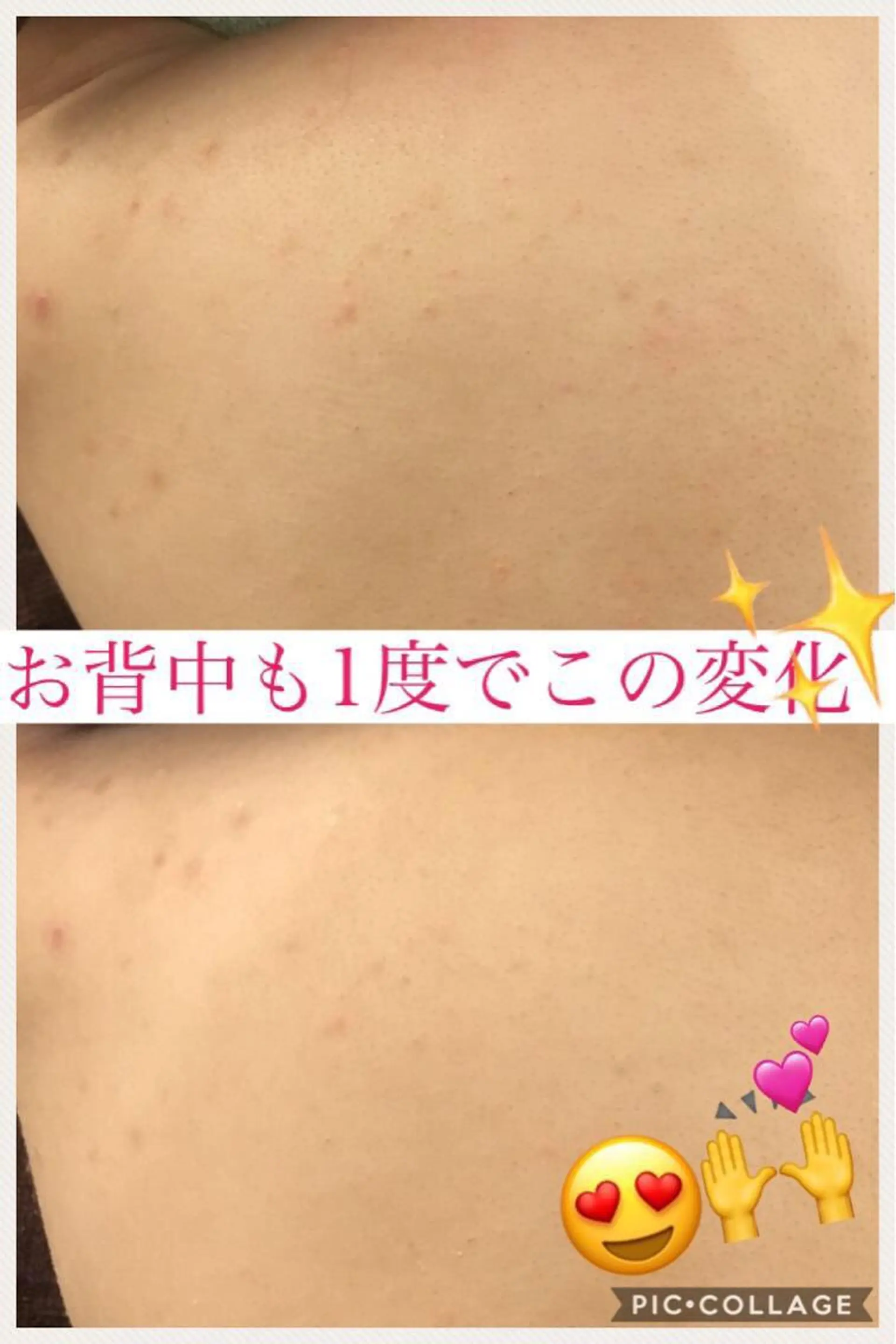 ミディアム カラー パーマ ヘアアレンジ メンズ キッズ ネイル マツエク・マツパ アクール　齋藤 ♡肌トラブル卒業のエステ・リラクイメージ