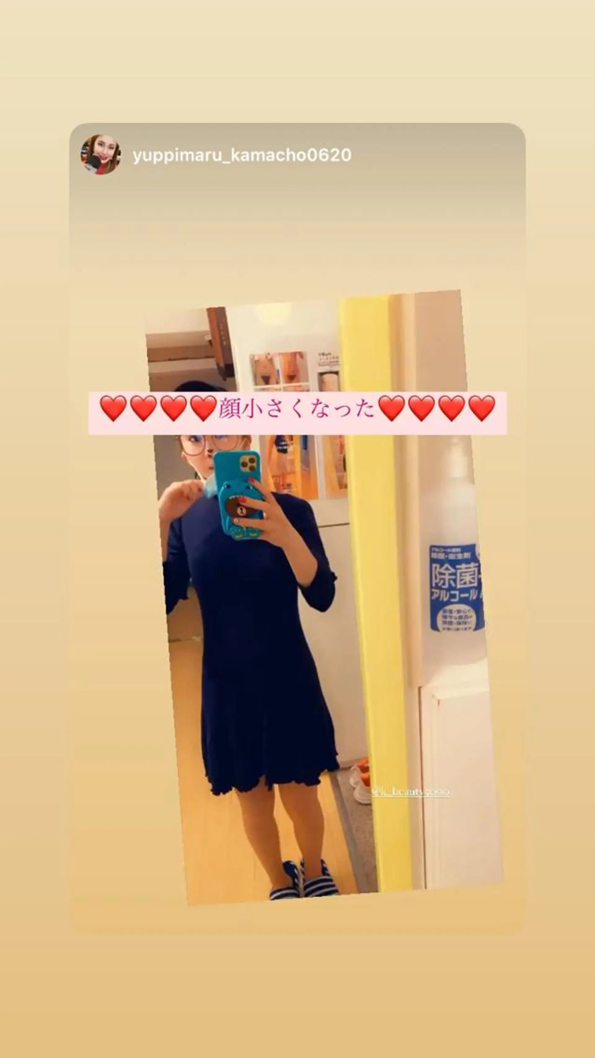 エステ 【ハイパーナイフ痩身&小顔コルギ&ハーブピーリング】K-Beauty　東新宿所属・kーbeauty痩身 フェイシャルのエステ・リラクイメージ