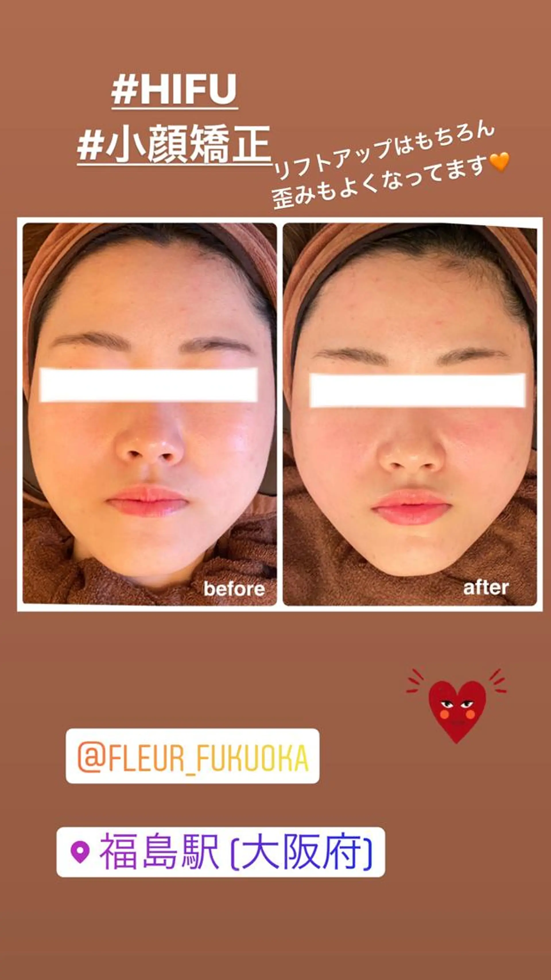 FLEUR大阪・整体 ・ハイフ・痩身・小顔のエステ・リラクイメージ