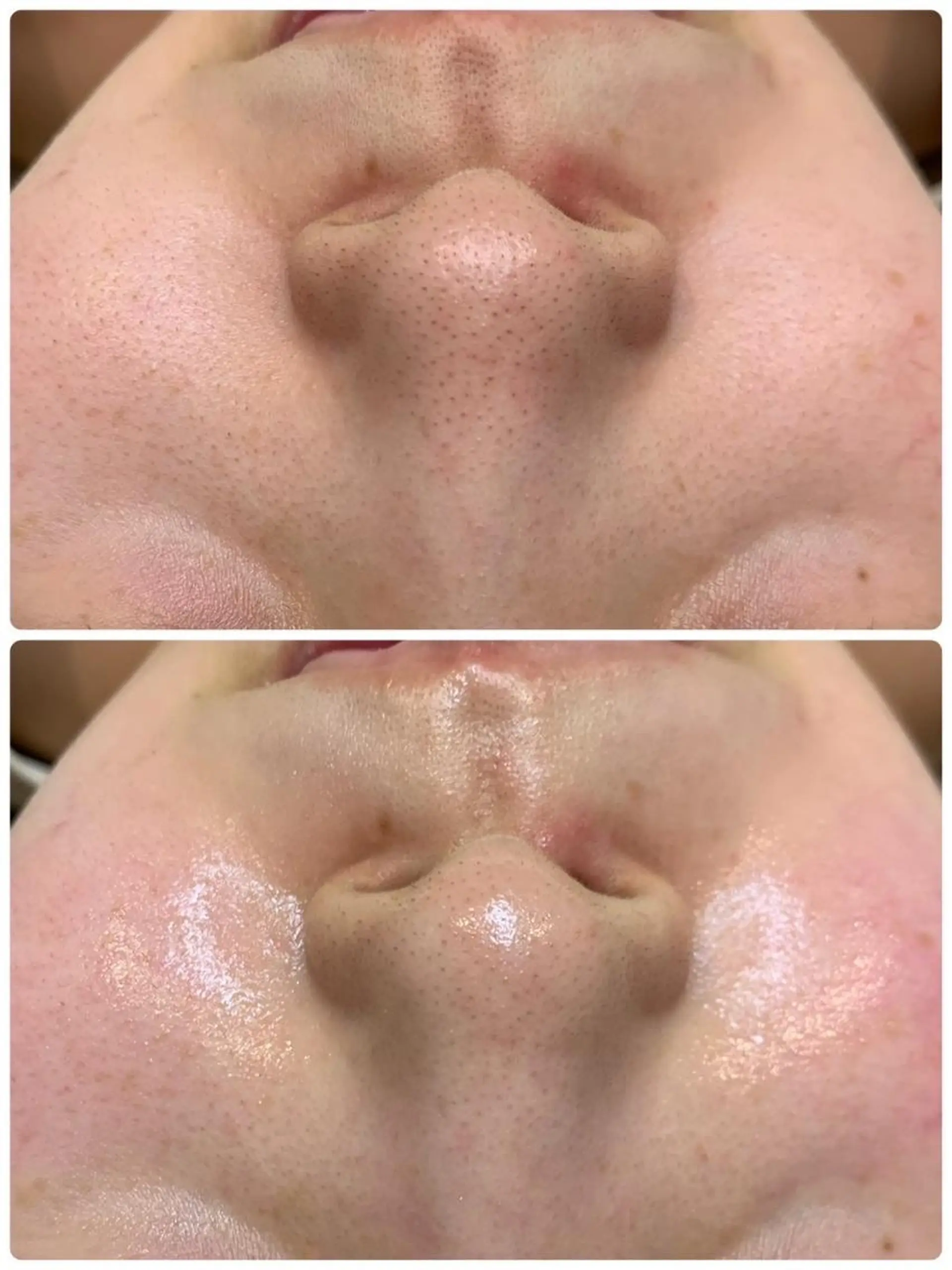 エステ Age24to29 💗RAYVIS池袋のエステ・リラクイメージ