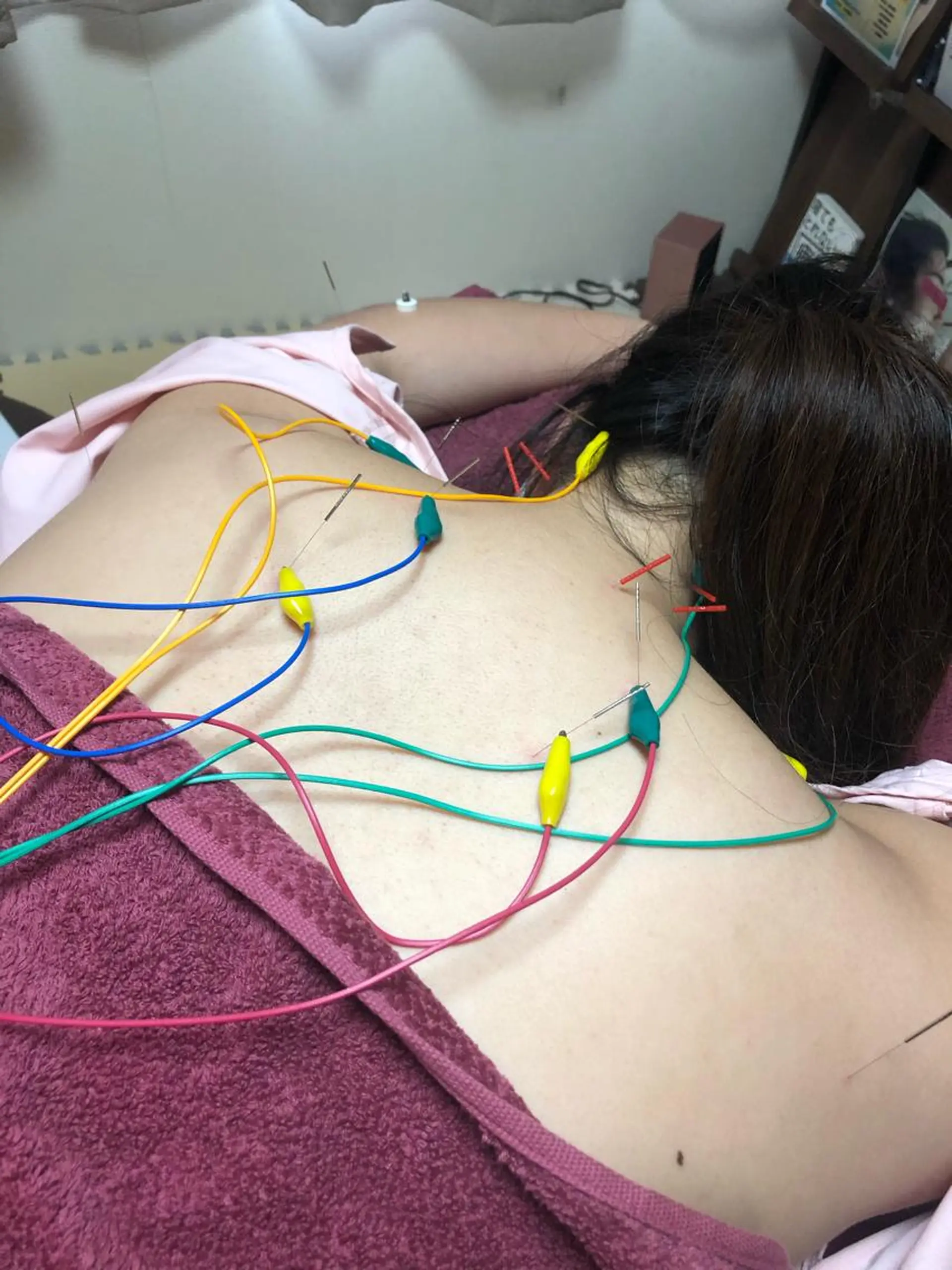 美容鍼灸女性専用 りんご鍼灸治療院のその他イメージ