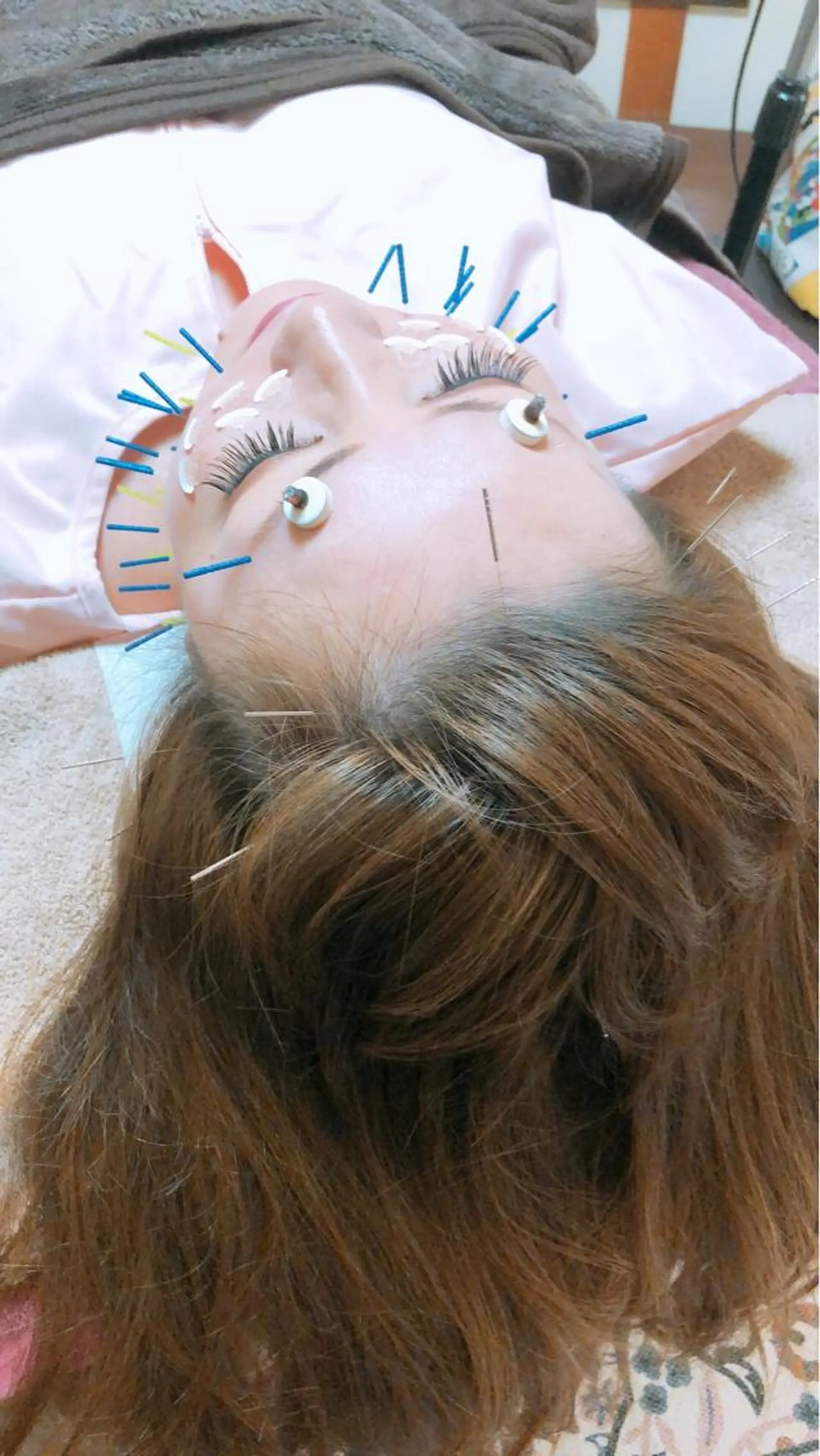 美容鍼灸女性専用 りんご鍼灸治療院のその他イメージ