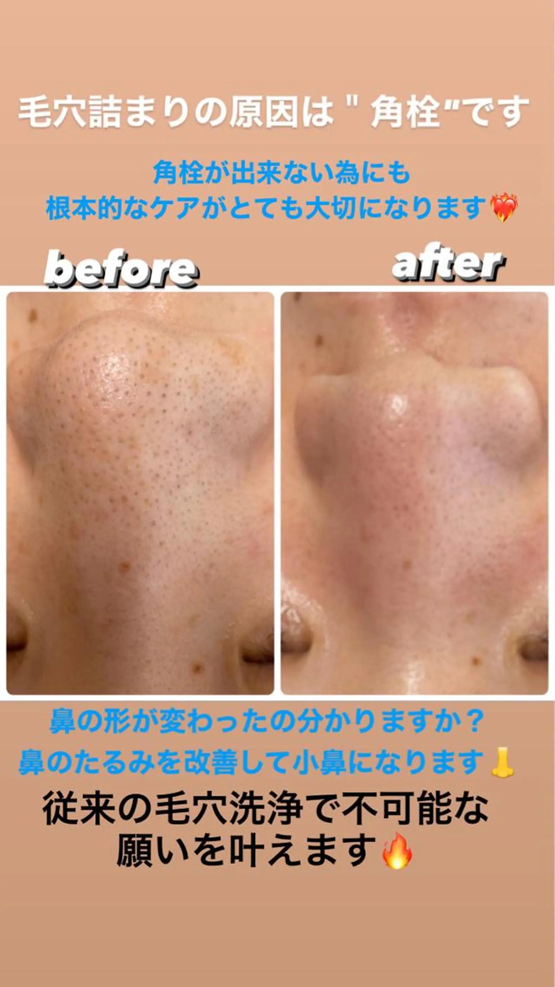 ショート カラー パーマ ヘアアレンジ メンズ キッズ ネイル マツエク・マツパ アイブロウ エステ ビューティーサロンRavi所属・ビューティーサロン Raviのエステ・リラクイメージ