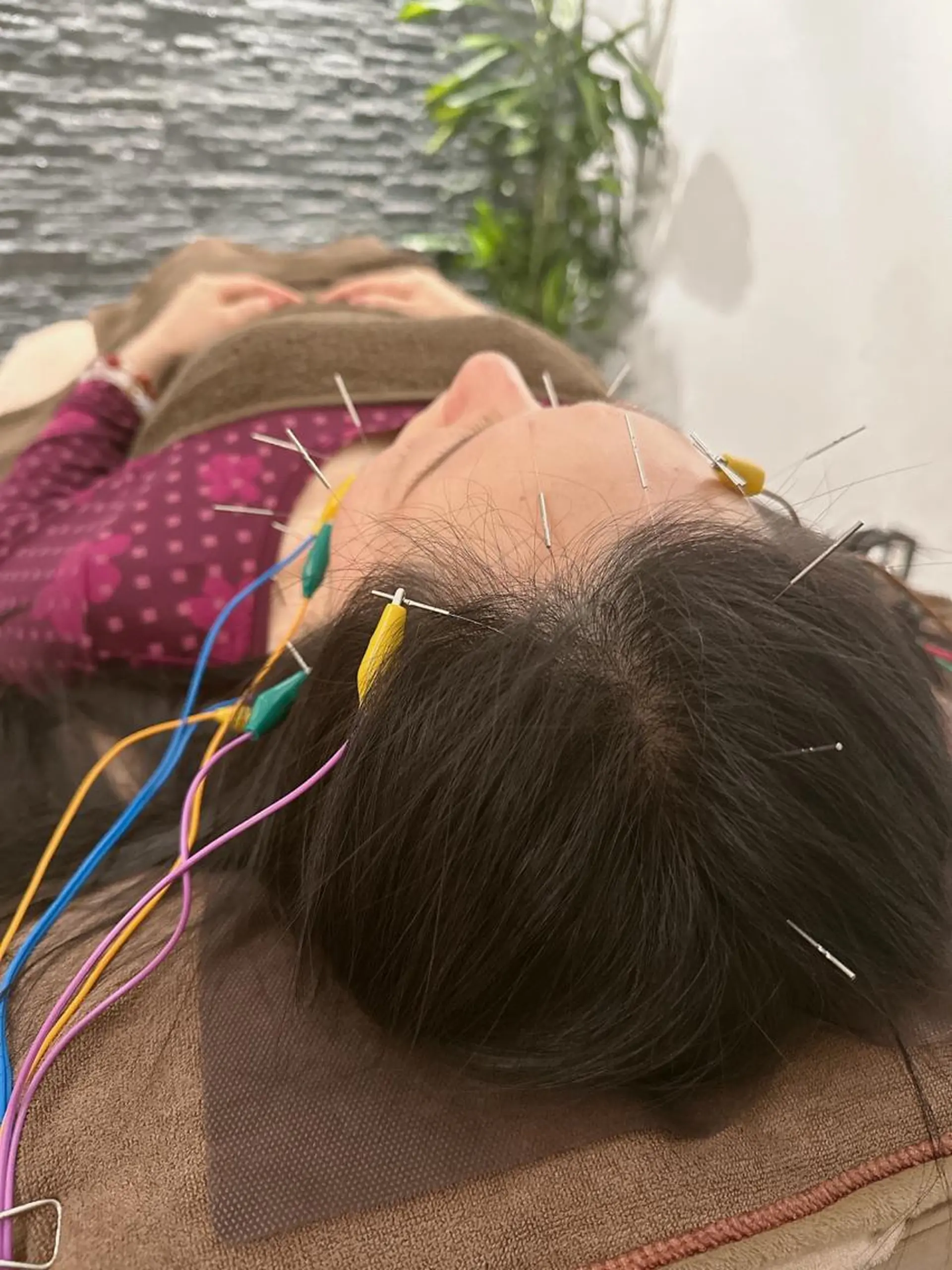 その他 美容鍼灸整体サロンBeauJu所属・小顔矯/美容鍼/鍼灸 BeauJuのその他イメージ