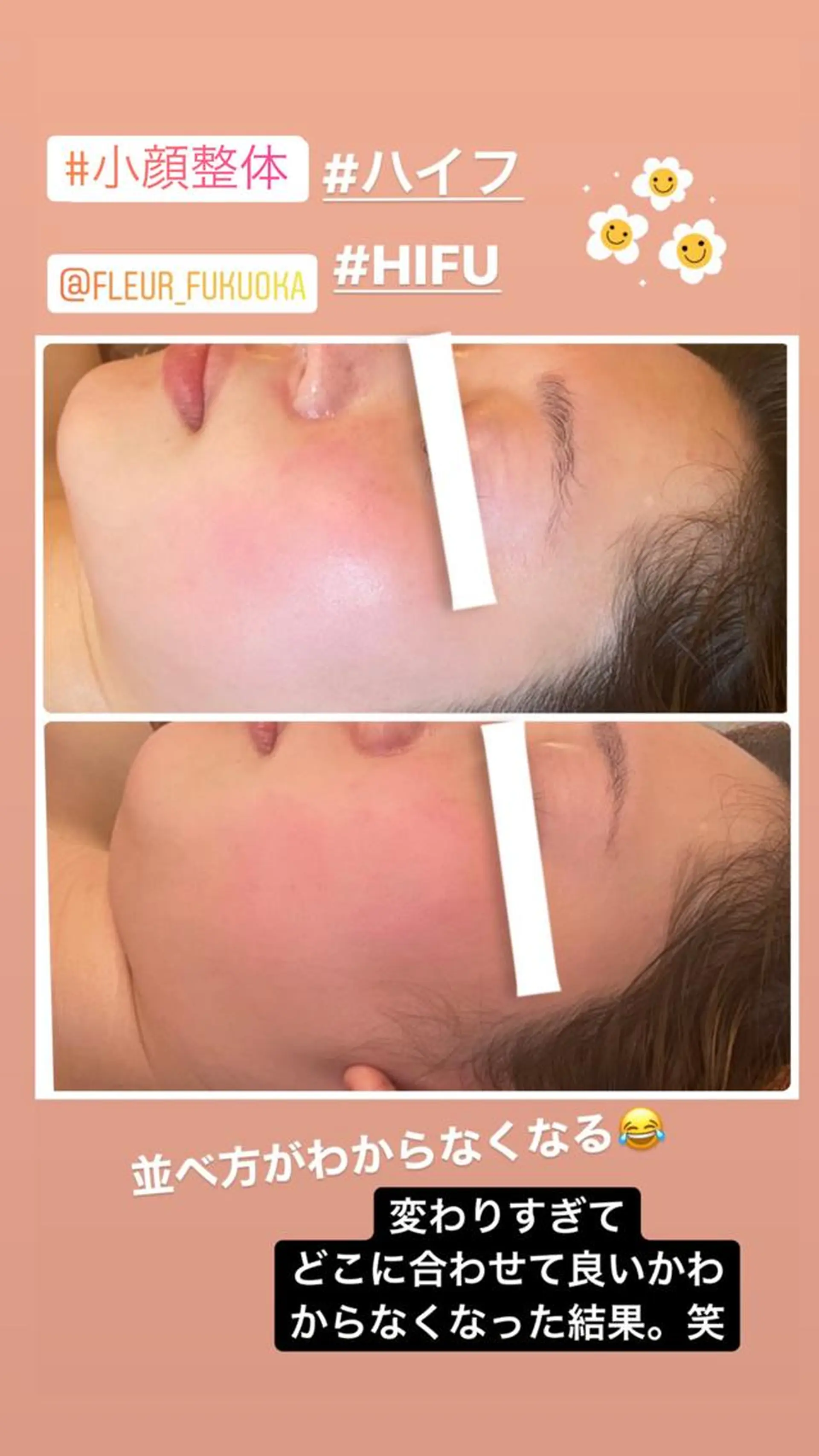 FLEUR大阪・整体 ・ハイフ・痩身・小顔のエステ・リラクイメージ