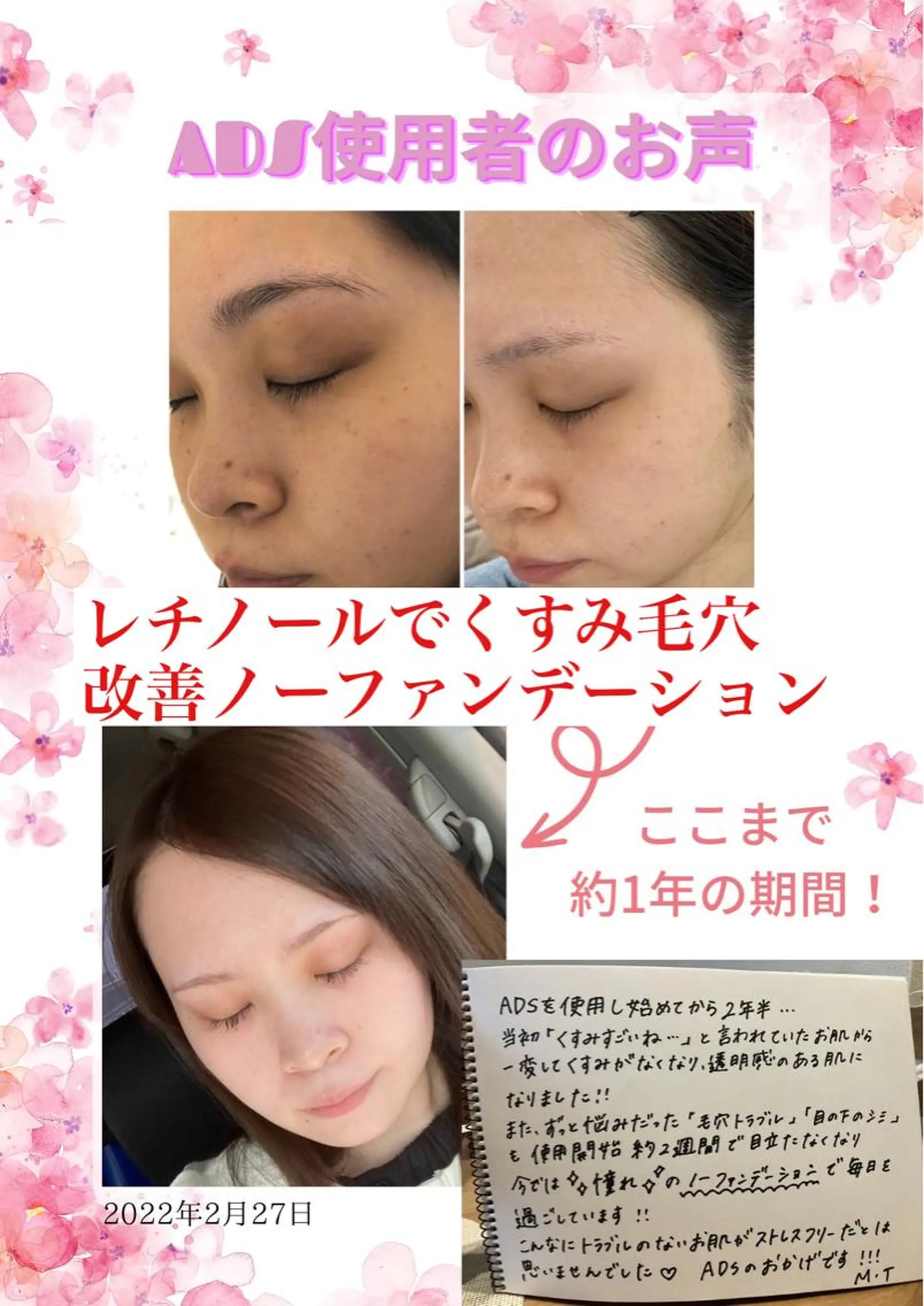 オアシス・さくら所属・中村貴子都度払い脱毛 小顔コルギのエステ・リラクイメージ