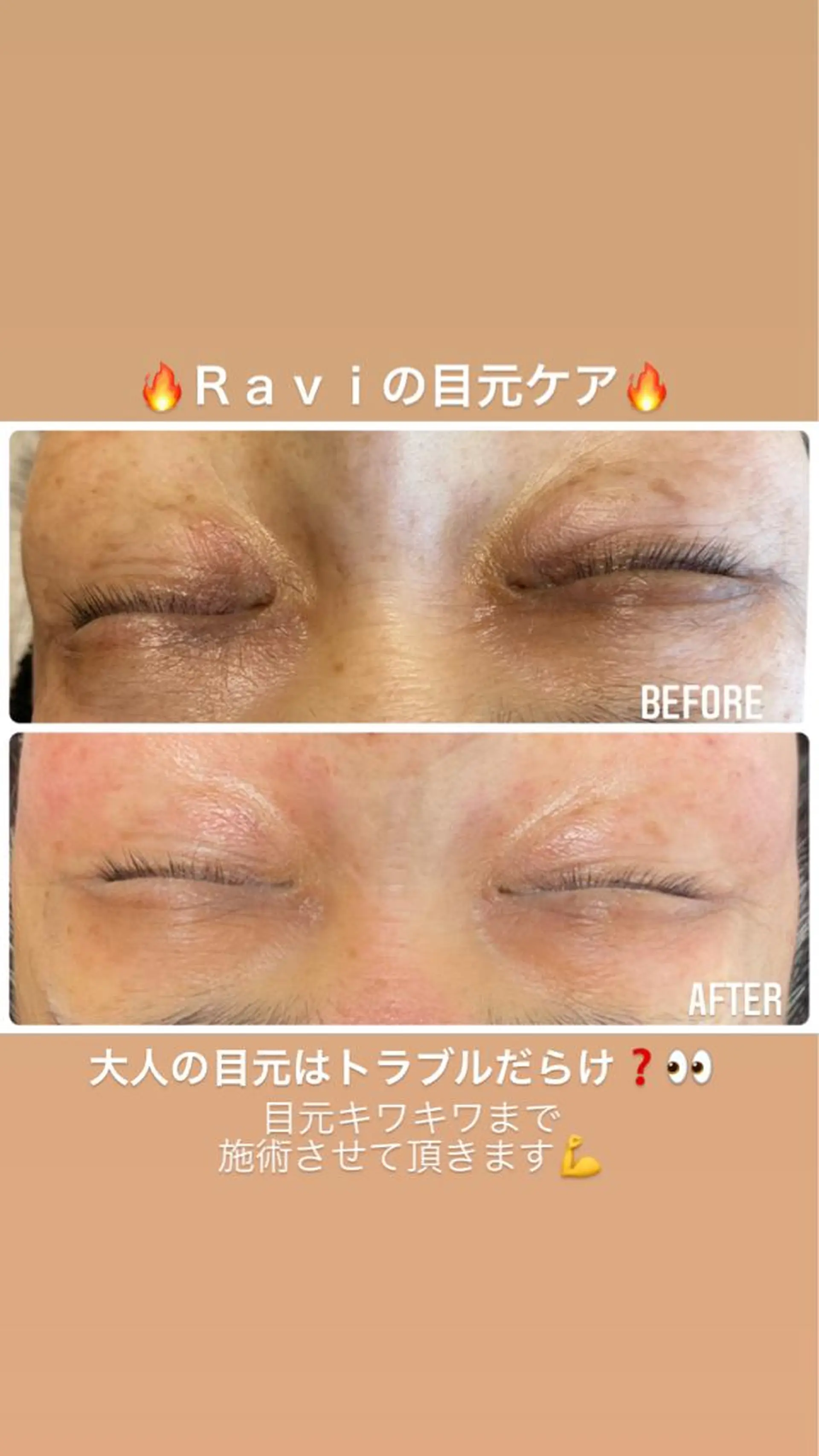 ショート カラー パーマ ヘアアレンジ メンズ ネイル マツエク・マツパ アイブロウ エステ ビューティーサロンRavi所属・ビューティーサロン Raviのエステ・リラクイメージ