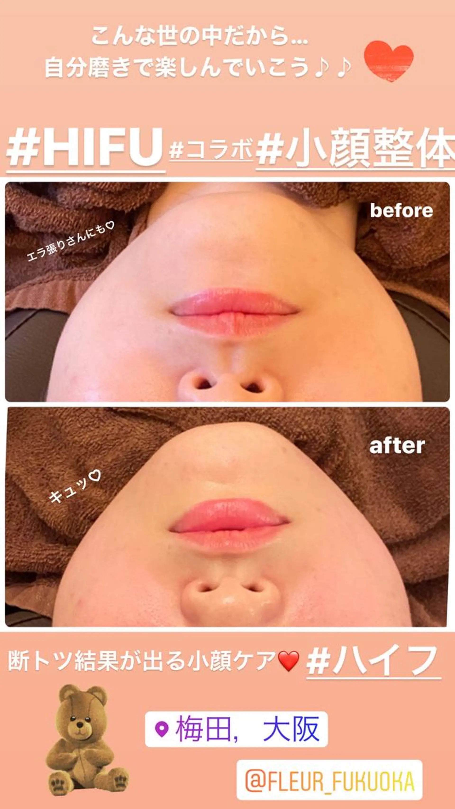 FLEUR大阪・整体 ・ハイフ・痩身・小顔のエステ・リラクイメージ