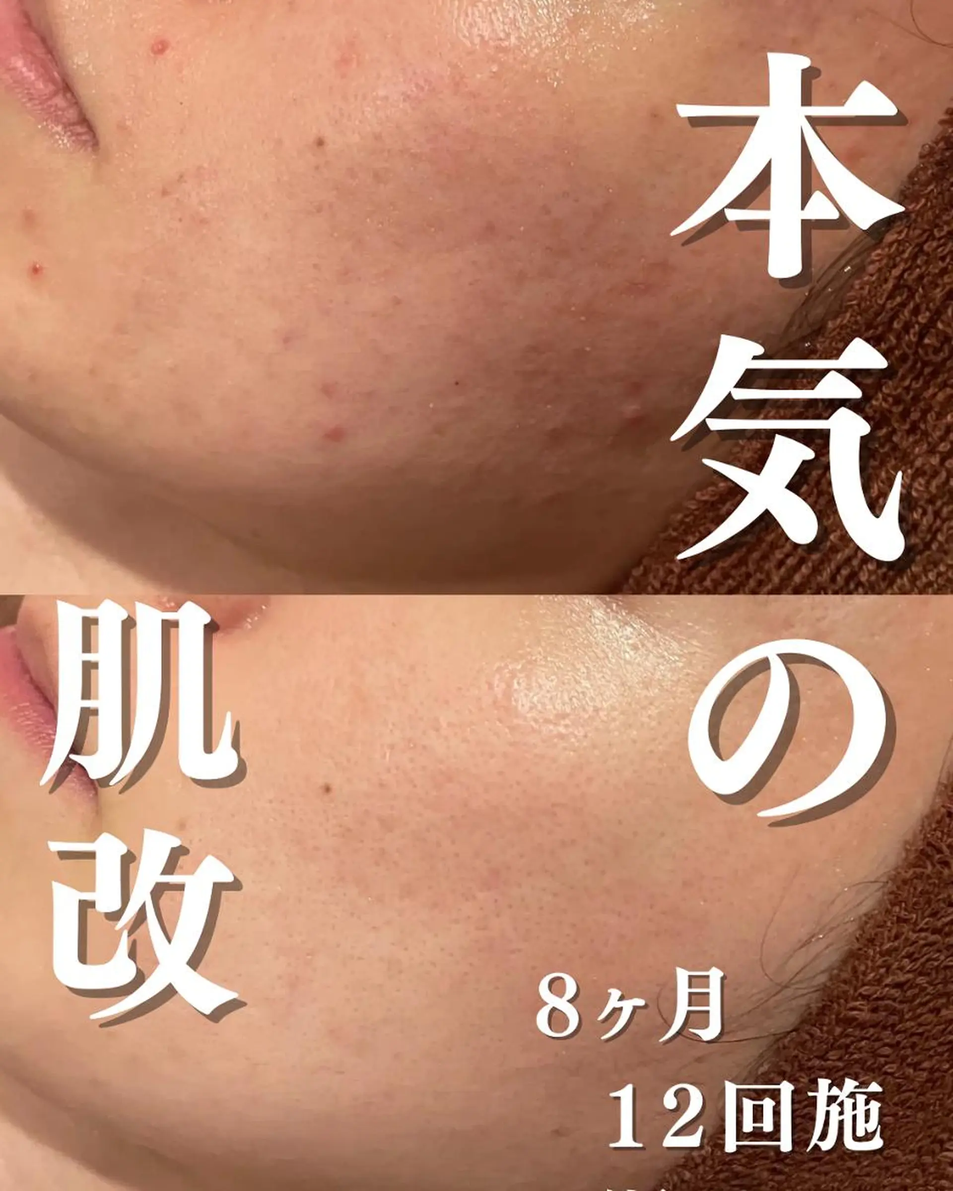 憧れの韓流すっぴん肌 🤎肌管理専門エステのエステ・リラクイメージ