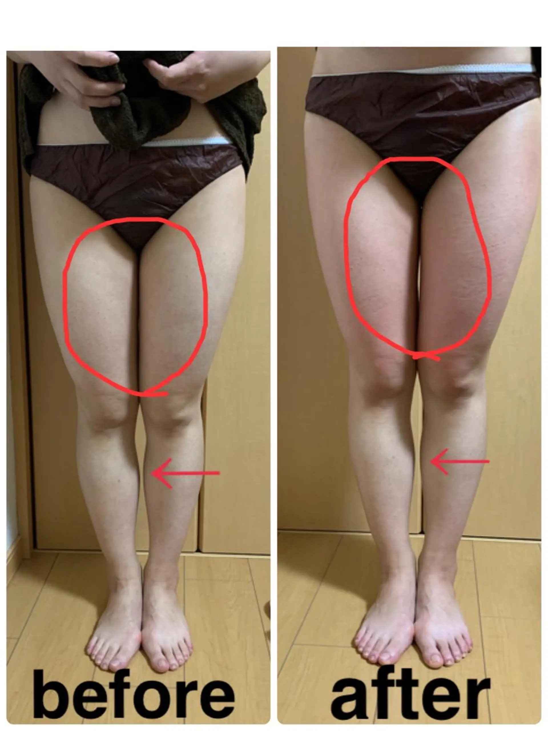 エステ リラク 痩身/脱毛/ネイル HARUKAのエステ・リラクイメージ