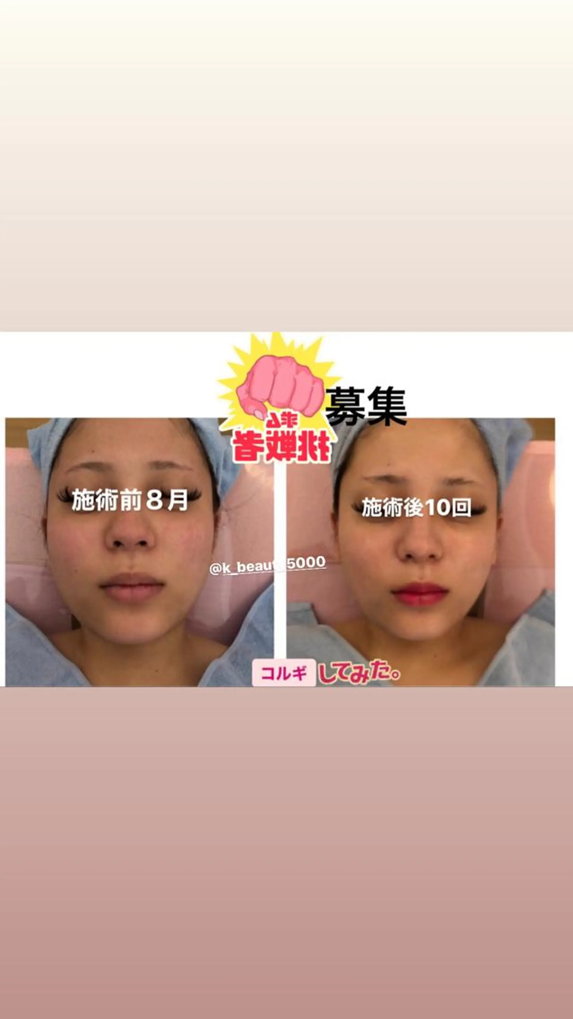 【ハイパーナイフ痩身&小顔コルギ&ハーブピーリング】K-Beauty　東新宿所属・kーbeauty痩身 フェイシャルのエステ・リラクイメージ