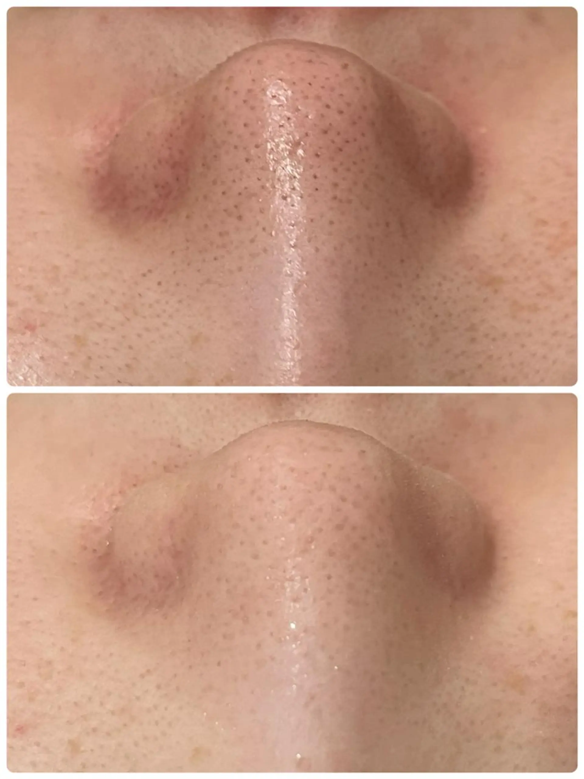 エステ リラク ニキビ特化型エステ 🍋最短で肌質改善のエステ・リラクイメージ