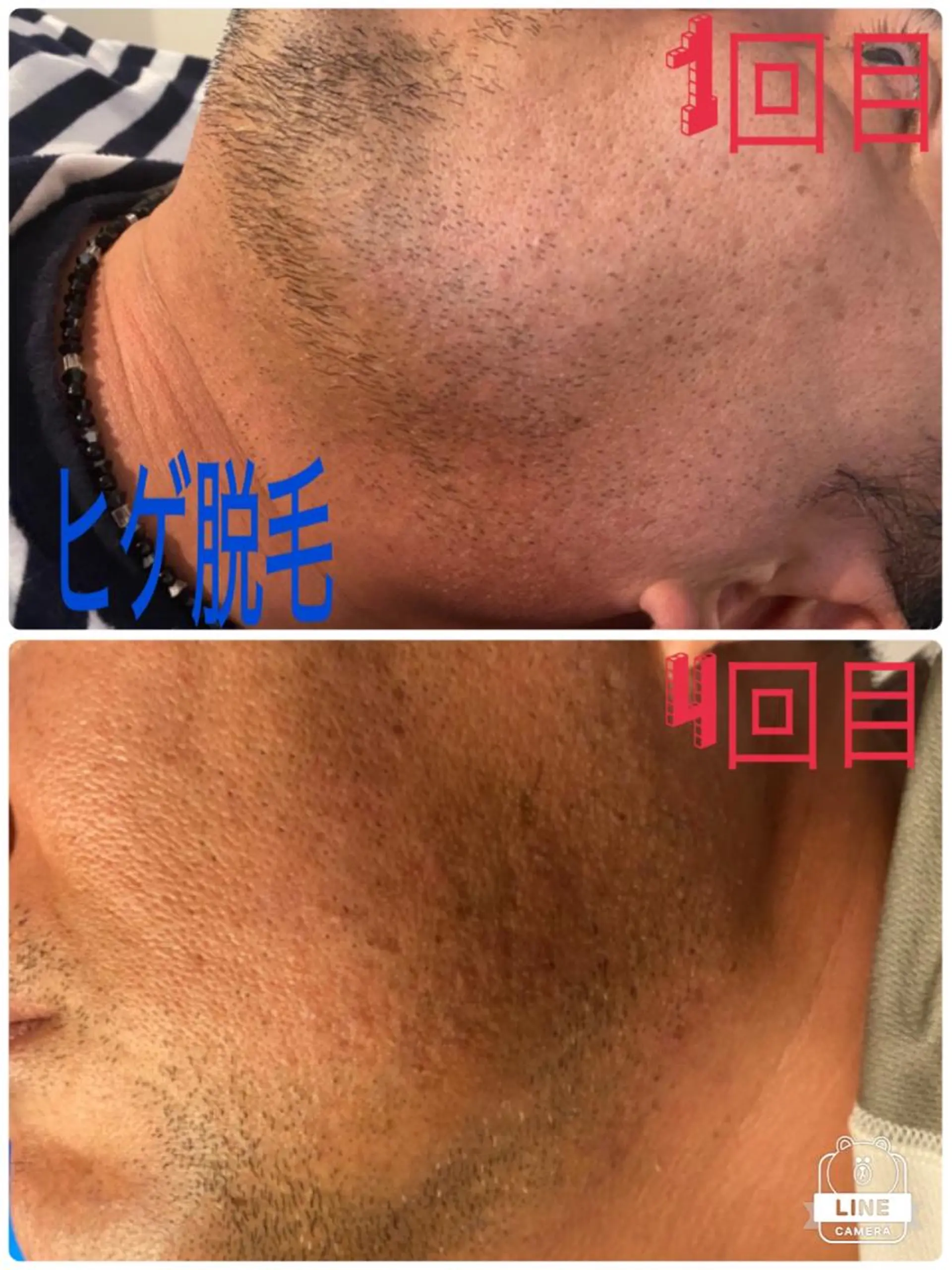 脱毛 salon Sunny所属・脱毛salon Sunnyのエステ・リラクイメージ