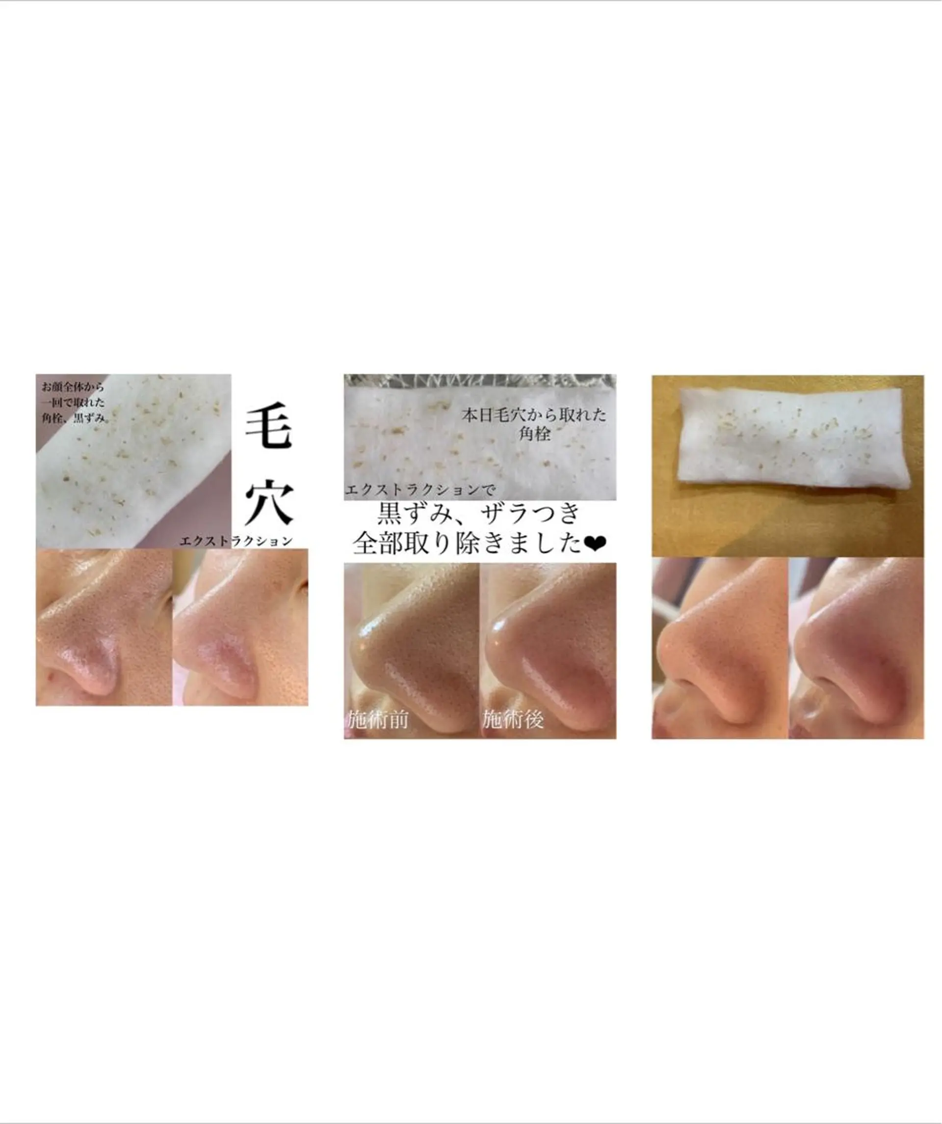 private salon Dea_maris シュガーリング&パーソナルボディケア所属・シミ改善・韓国肌管理 ボディメイク痩身のその他イメージ