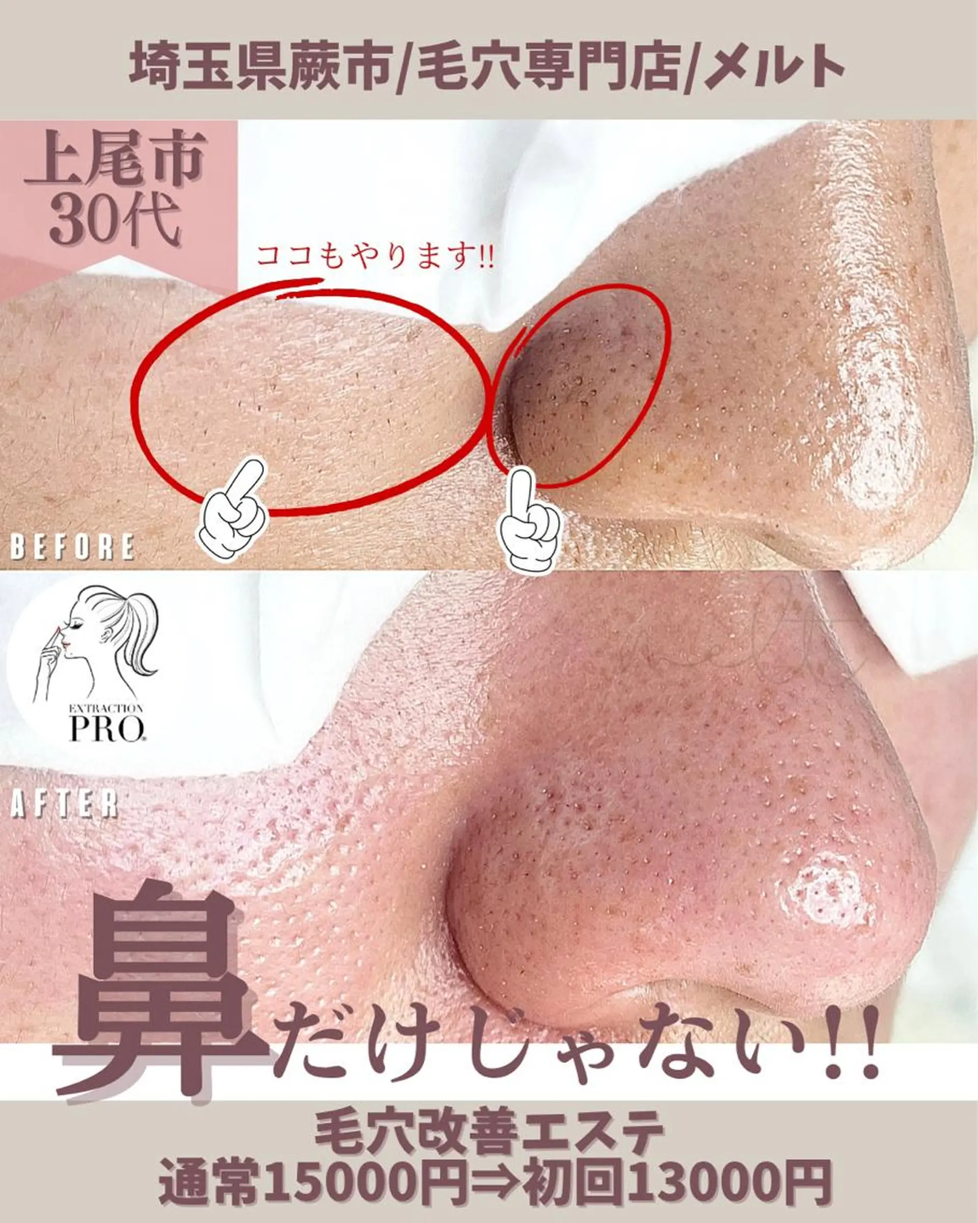 エステ melt まみのマツエク・マツパデザイン