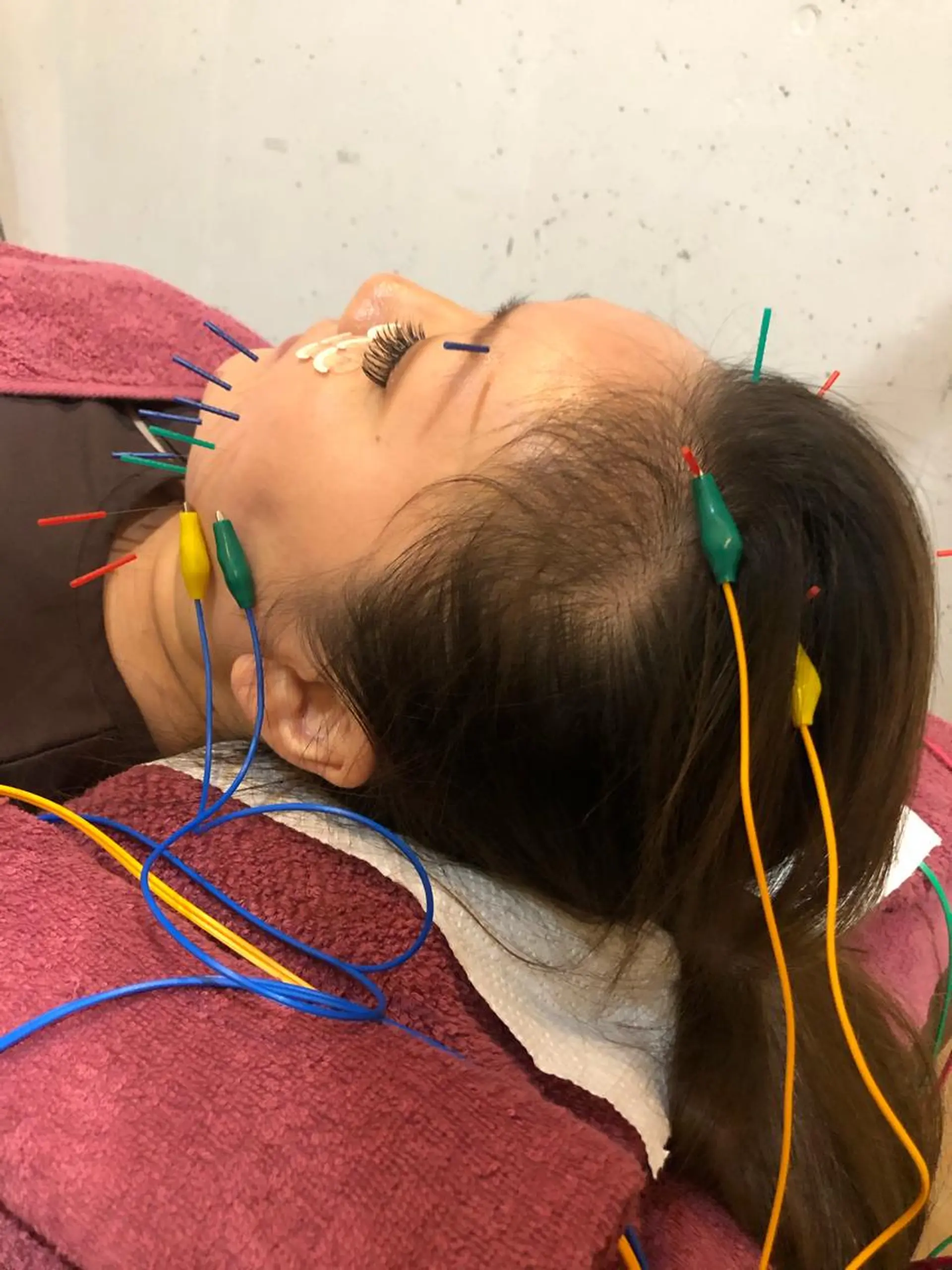 美容鍼灸女性専用 りんご鍼灸治療院のその他イメージ