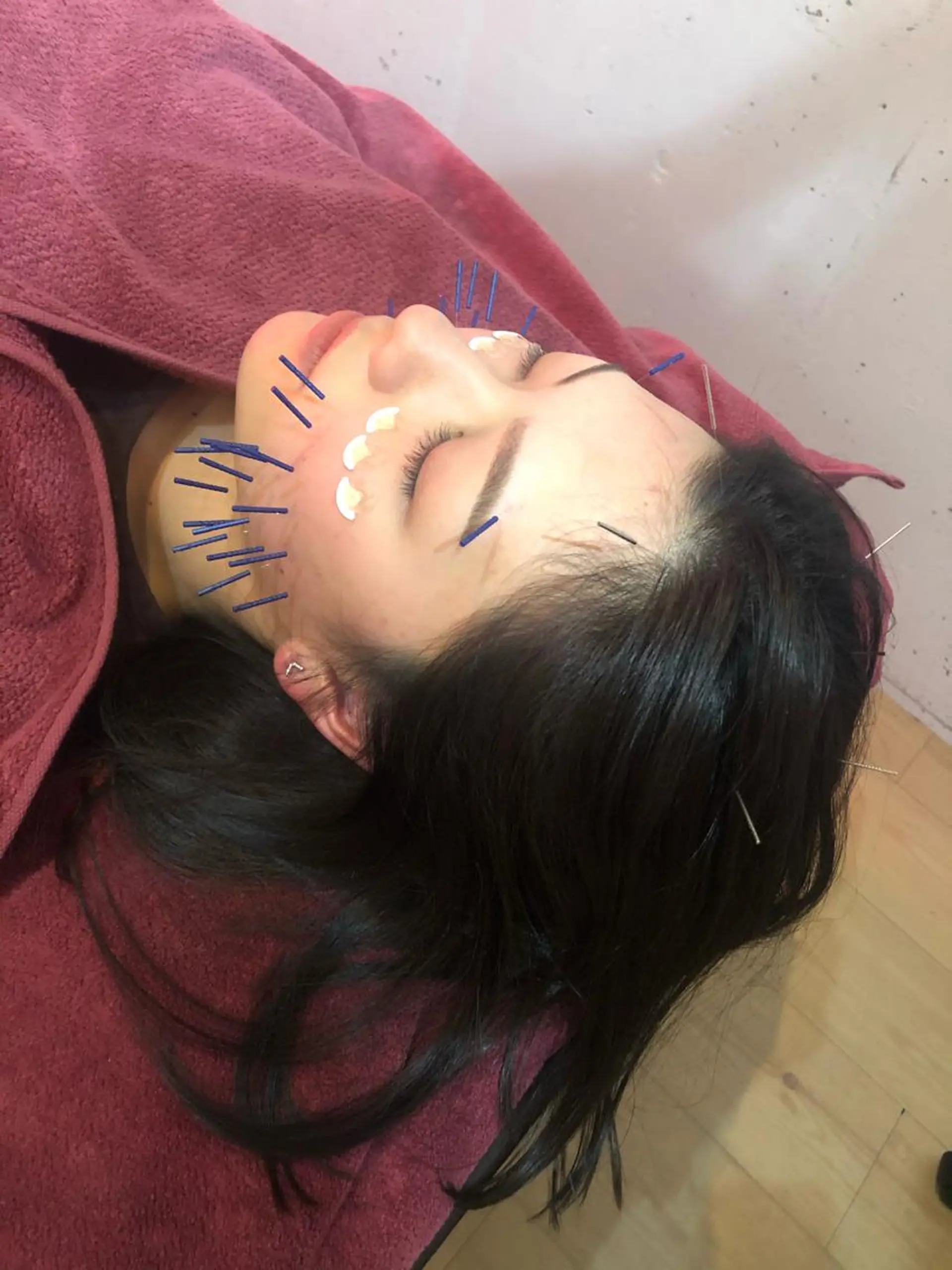 エステ リラク 美容鍼灸女性専用 りんご鍼灸治療院のその他イメージ